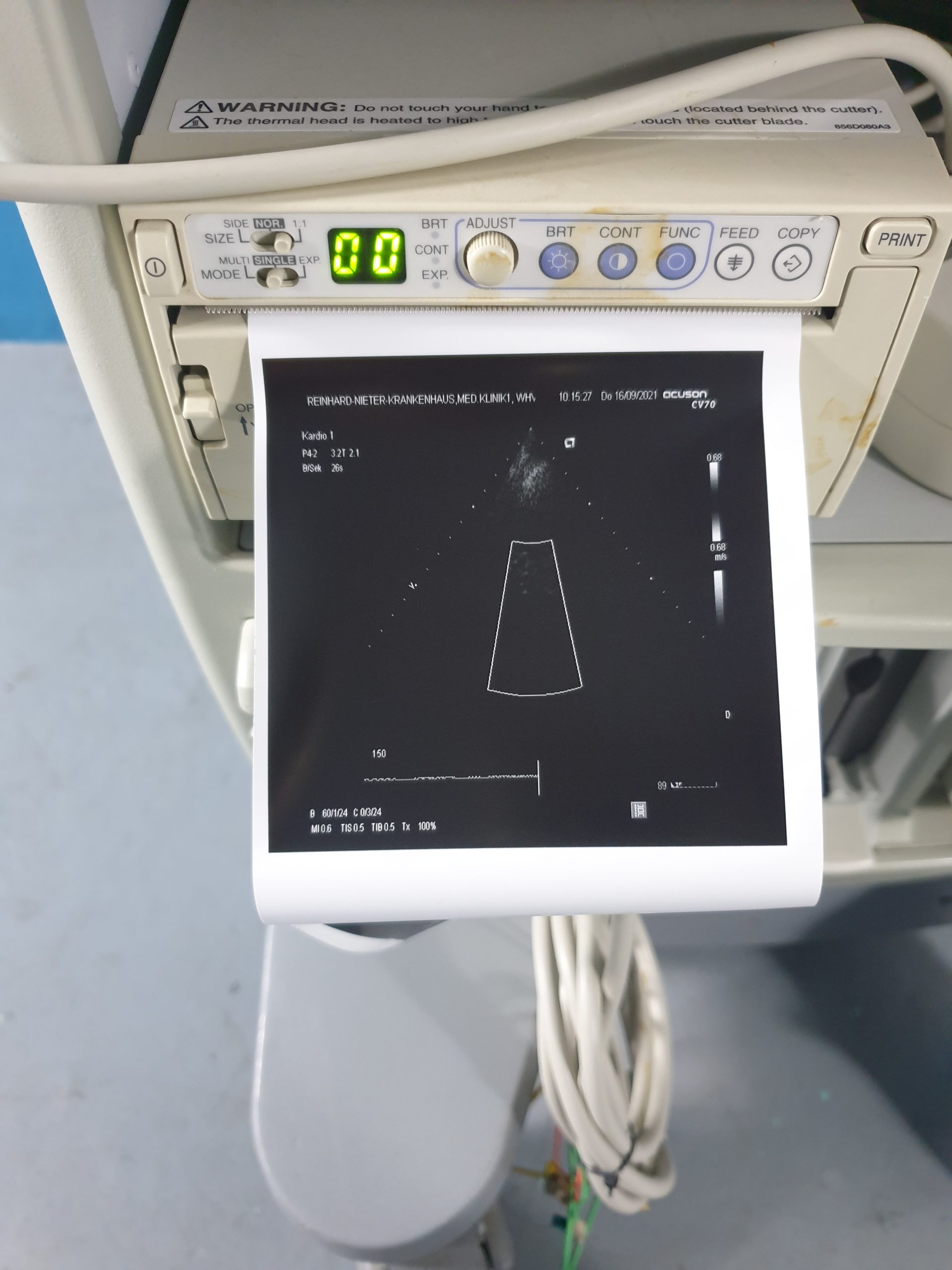 Siemens acuson CV70 // CV 70 C6-2 Konvex + 5.0L45 Linear + P4-2 Echo Kardio DOM 2004 thumbnail 9