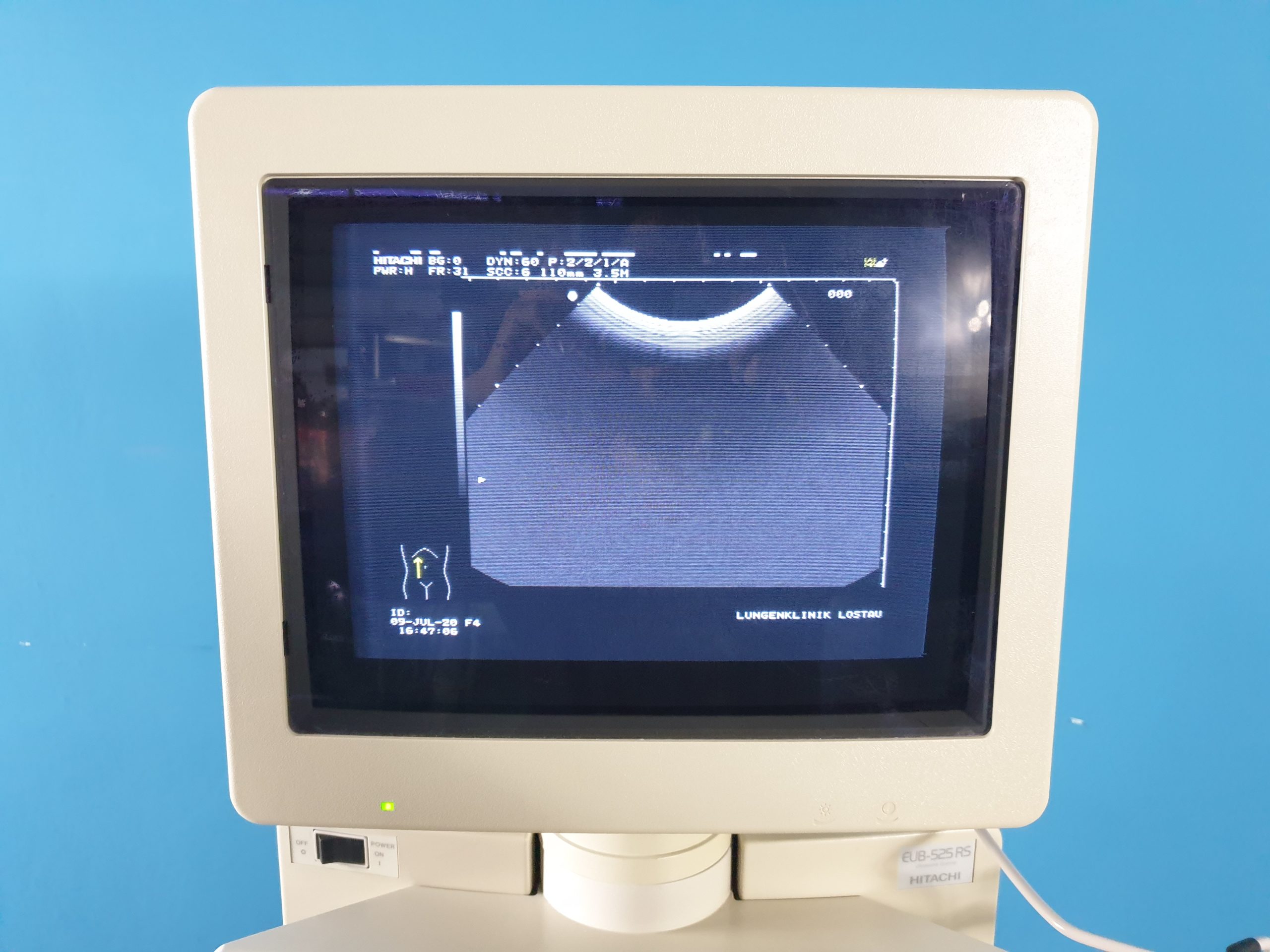 Hitachi EUB-525 RS + 3.5 Mhz Konvex Farbdoppler Ultraschallgerät thumbnail 2