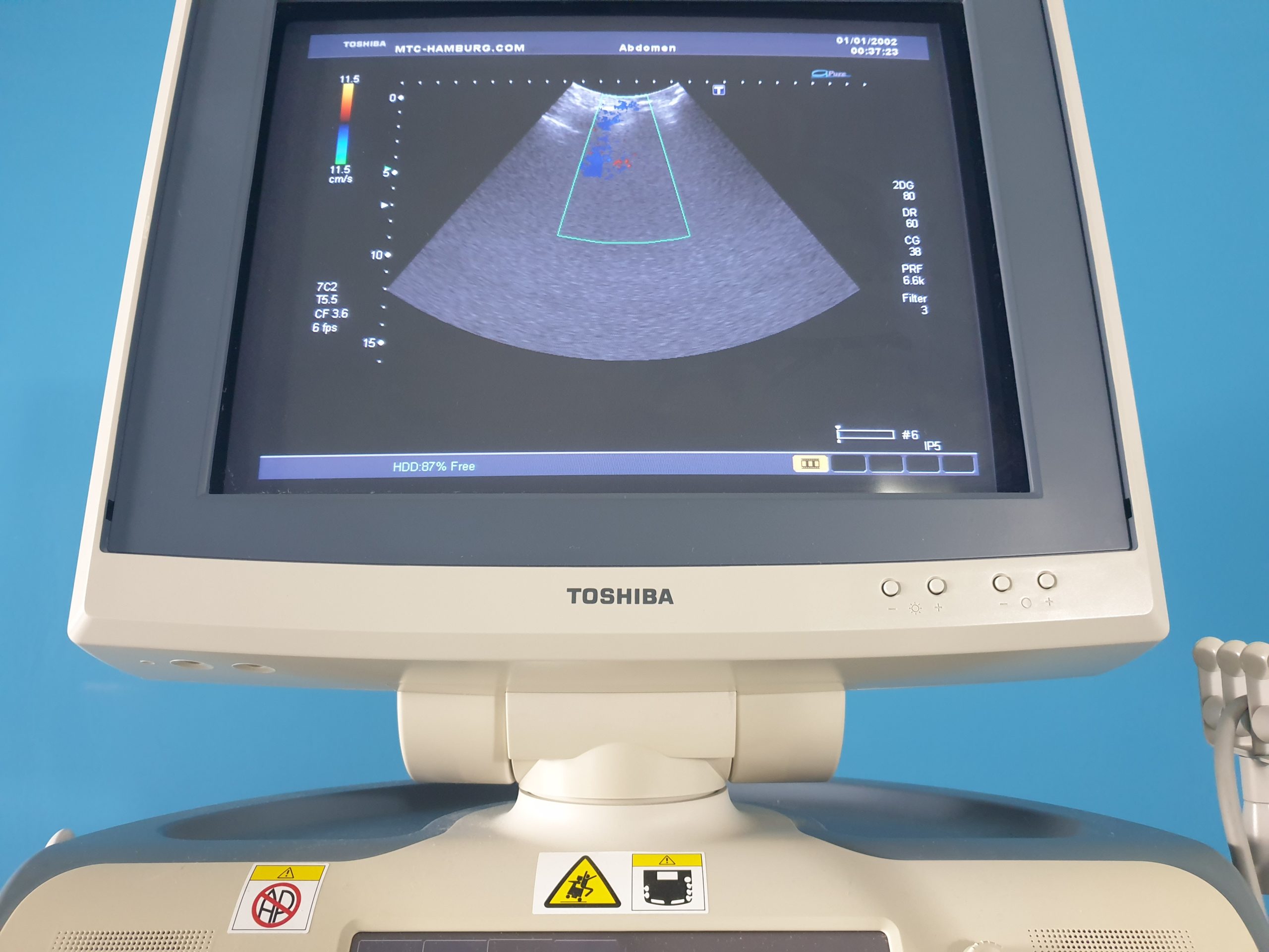 Toshiba PVT-575MV 4D konvexsonde Ultraschallsonde ultrasound probe thumbnail 2