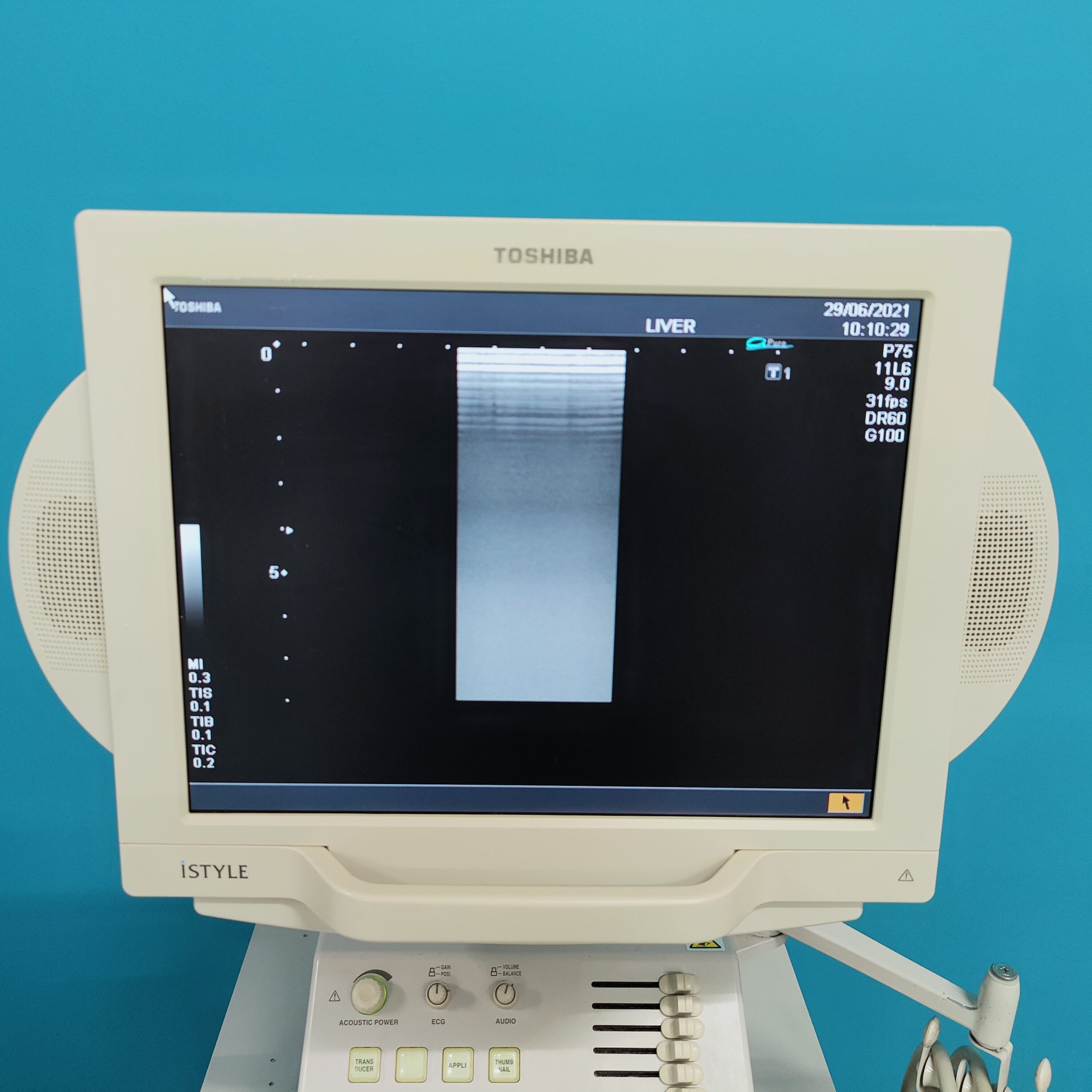 Toshiba Nemio XG SSA-580A – PVM-375AT – PLM-703AT – PSM-30BT Echo Kardio – P93 Farbdoppler Doppler thumbnail 4