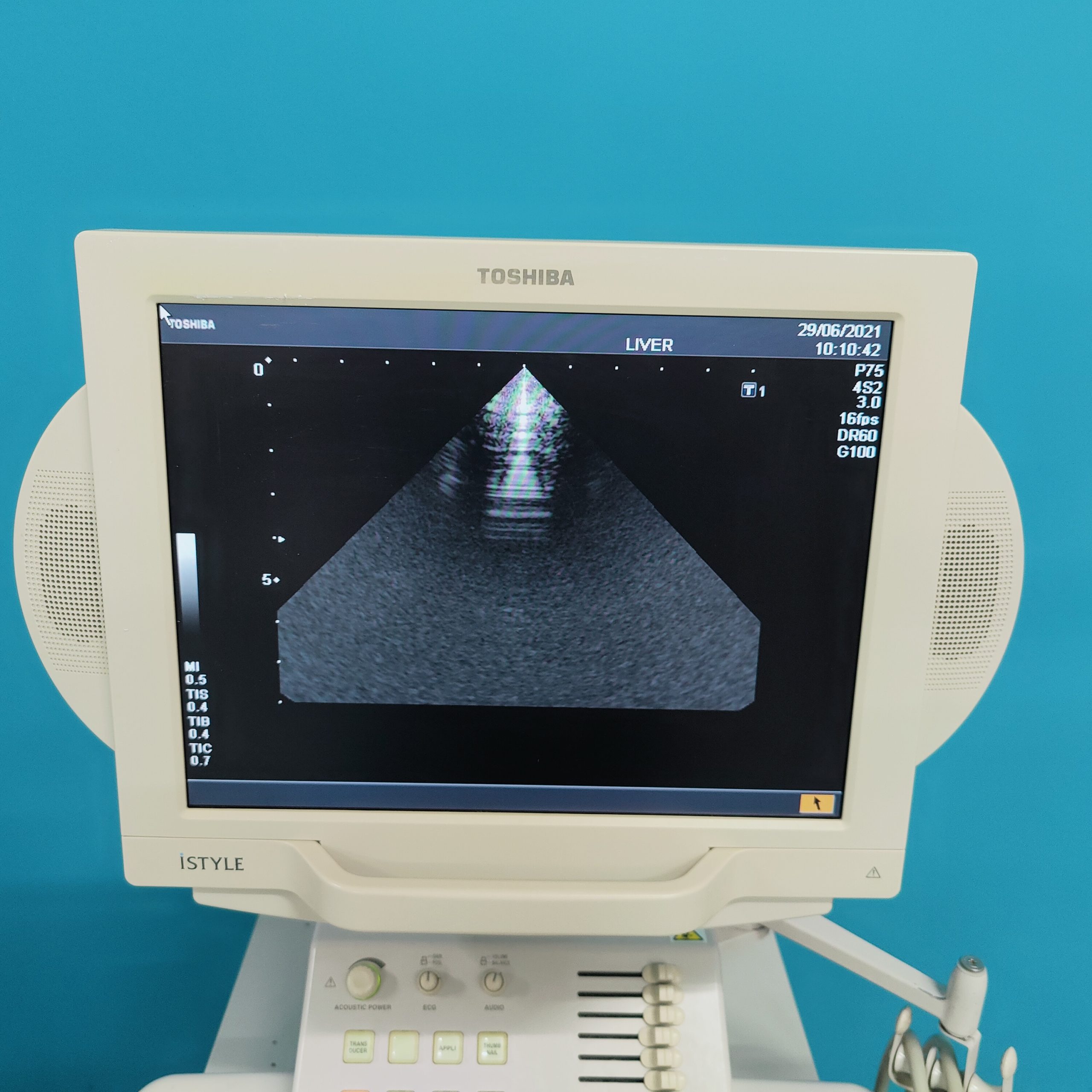 Toshiba Nemio XG SSA-580A – PVM-375AT – PLM-703AT – PSM-30BT Echo Kardio – P93 Farbdoppler Doppler thumbnail 6