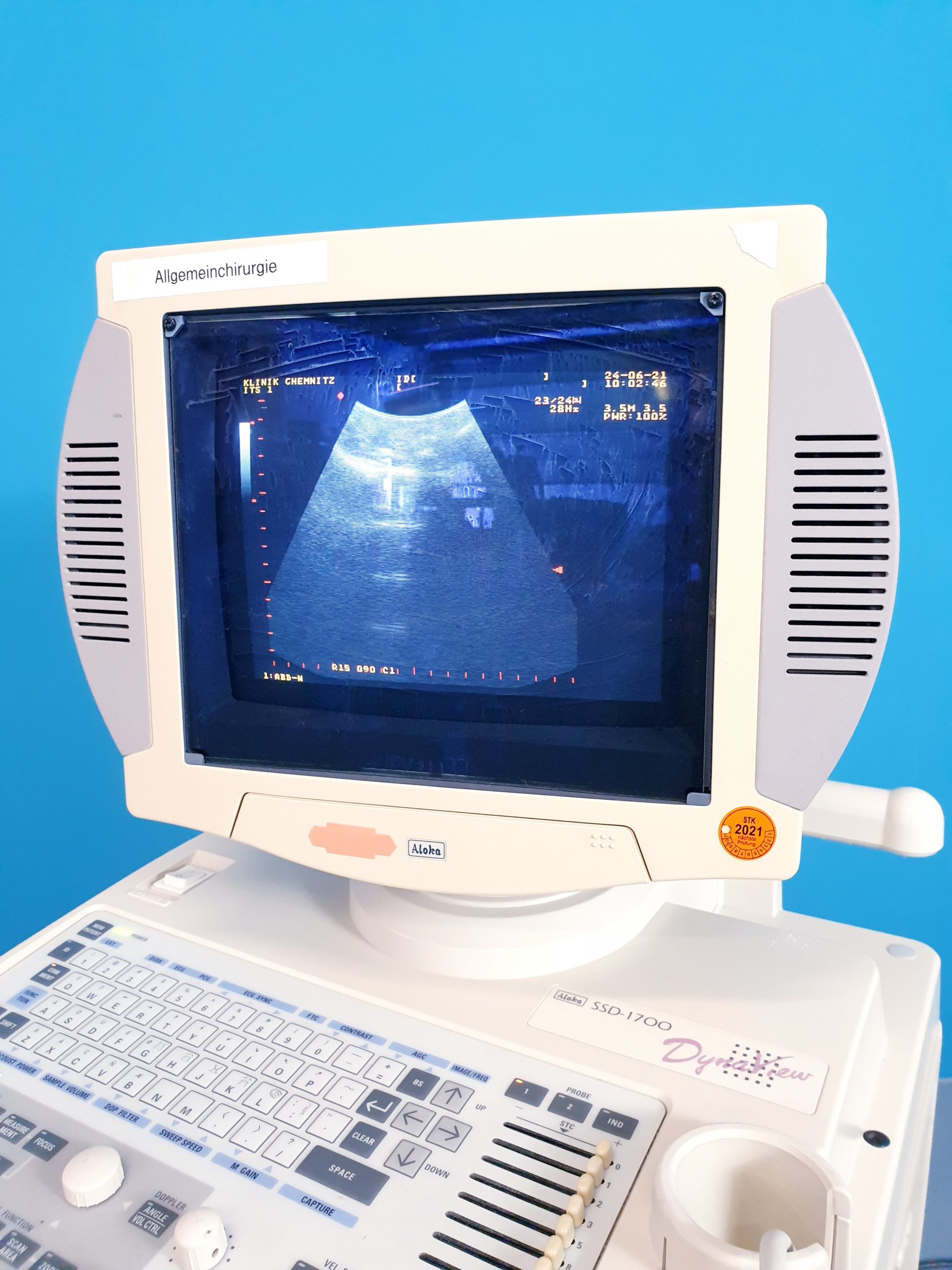 Aloka SSD-1700 DynaView + UST-979-3.5 konvex Sonde Ultraschallgerät thumbnail 3