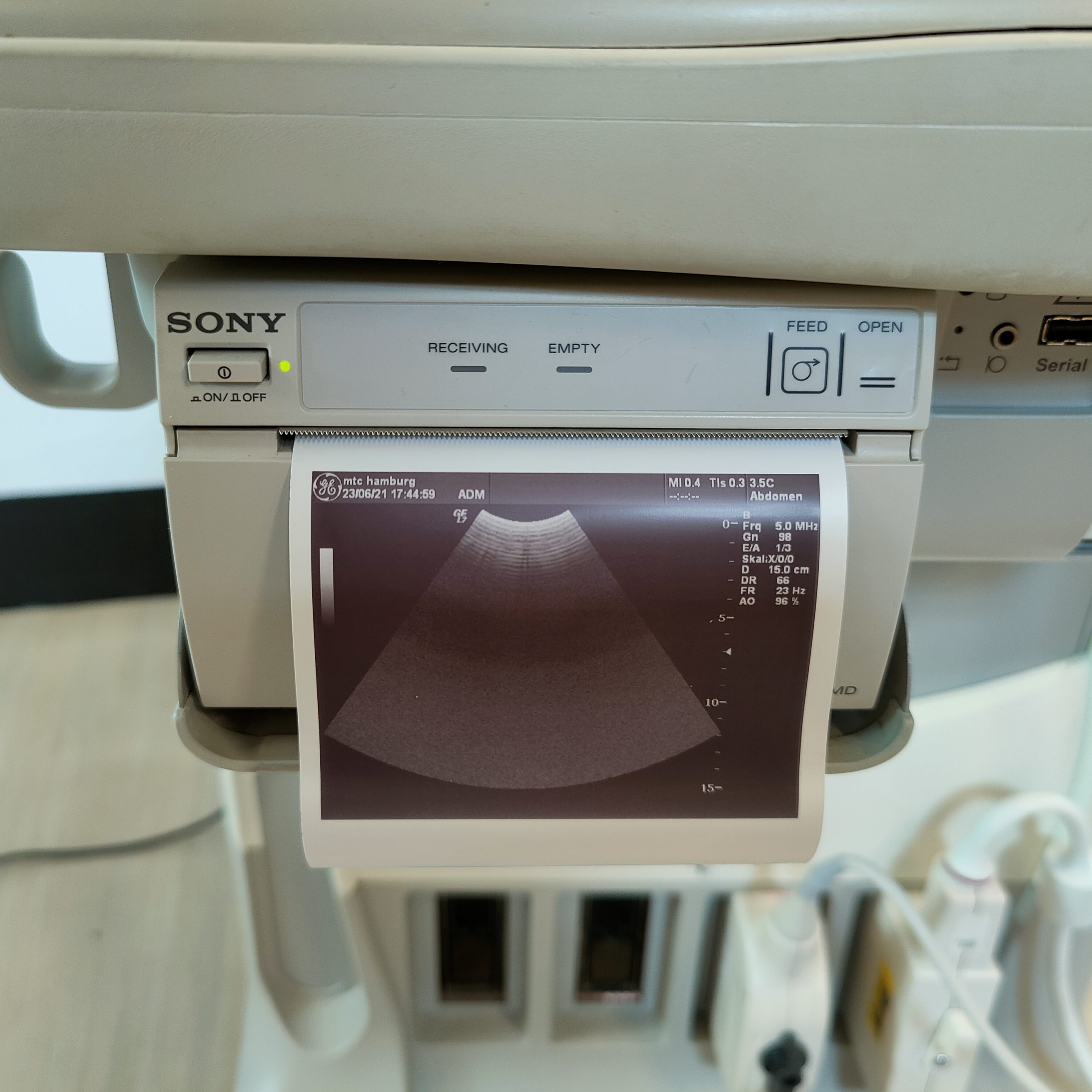 GE Logiq 7 // Logiq7 mit 3.5C konvex Sonde und 10L Linear-Sonde Doppler thumbnail 5