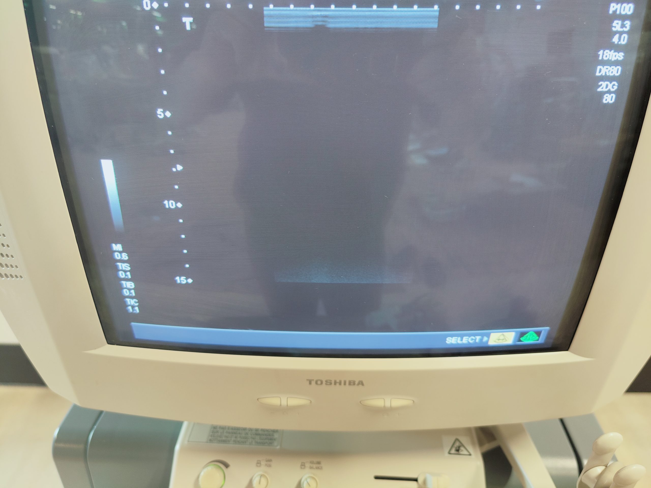 Toshiba PLF-308P // PLF 308 P Biopsy Probe – Transducer– Linear Biopsy Sonde thumbnail 3