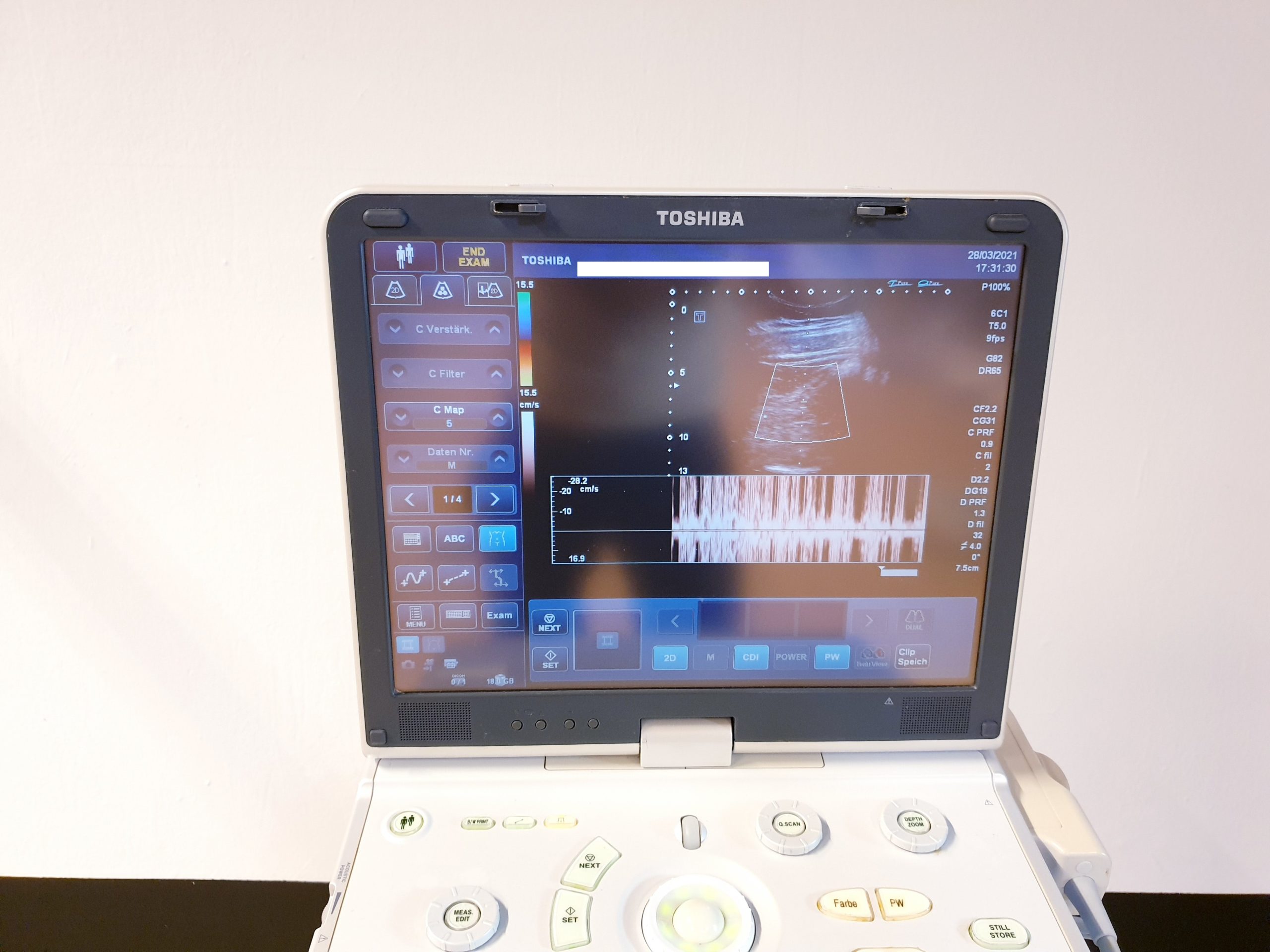 Toshiba Viamo mit PVT-375ST // PVT 375 ST Konvex Probe, Printer Farhrbar — image 1 of 7