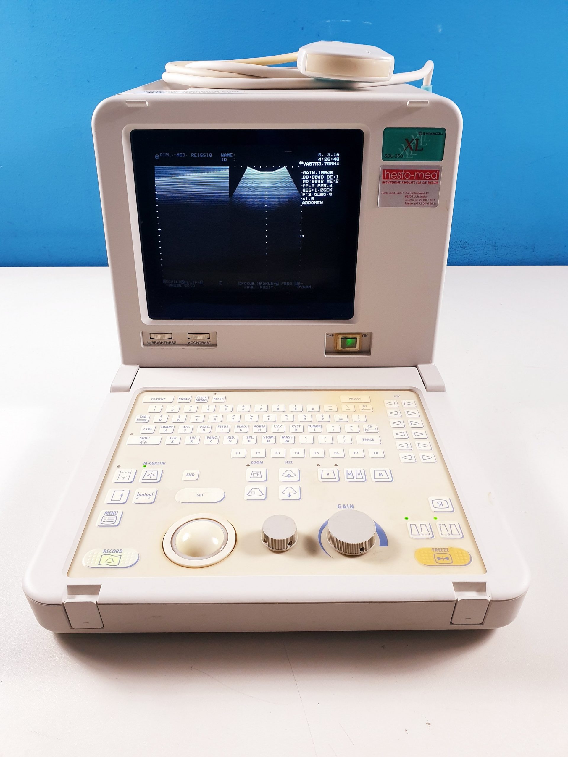 Schimadzu SDU-350XL // SDU 350 XL + VA57R-0375U KONVEX SONDE Tragbar — image 1 of 9