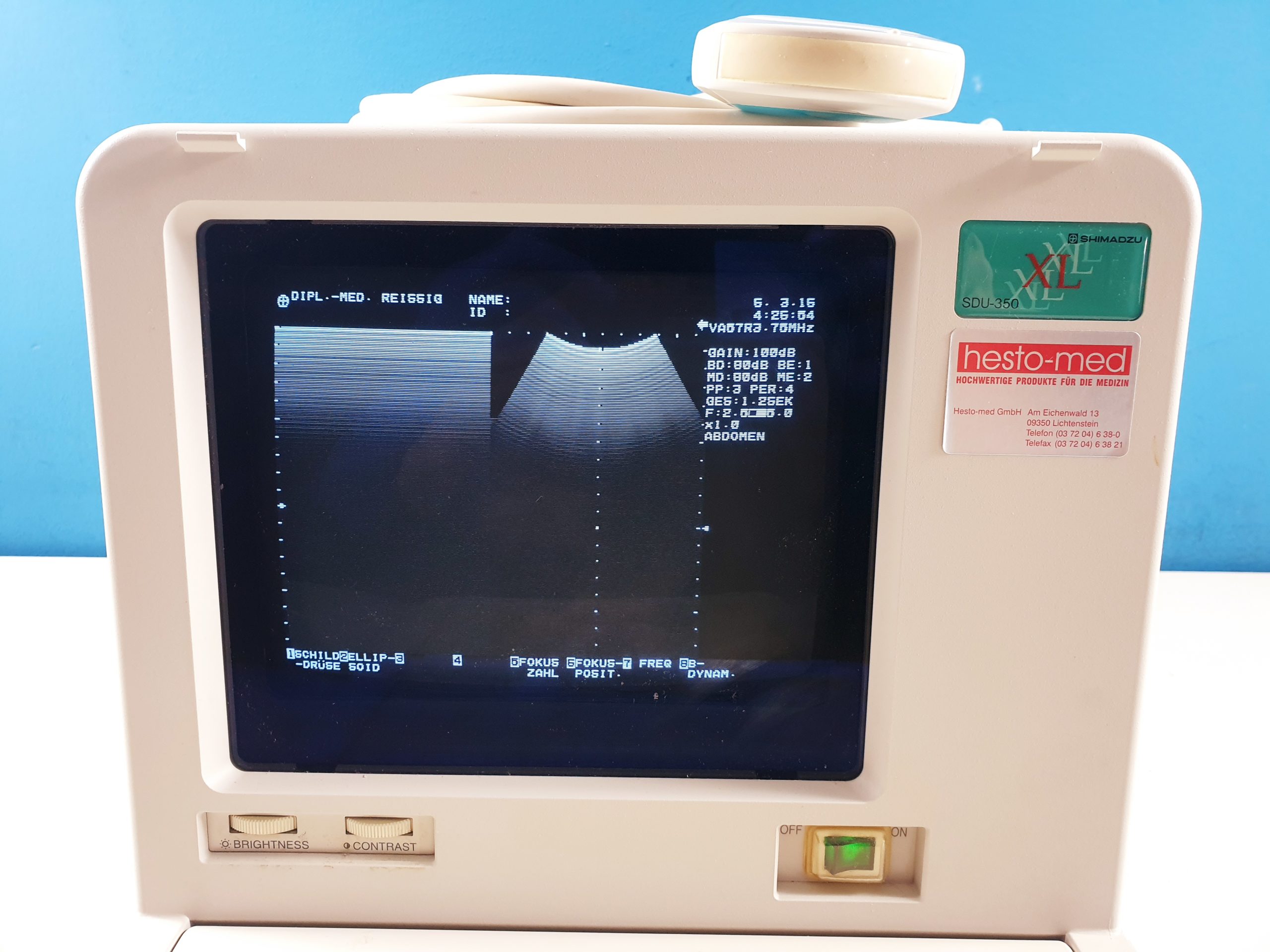 Schimadzu SDU-350XL // SDU 350 XL + VA57R-0375U KONVEX SONDE Tragbar thumbnail 3