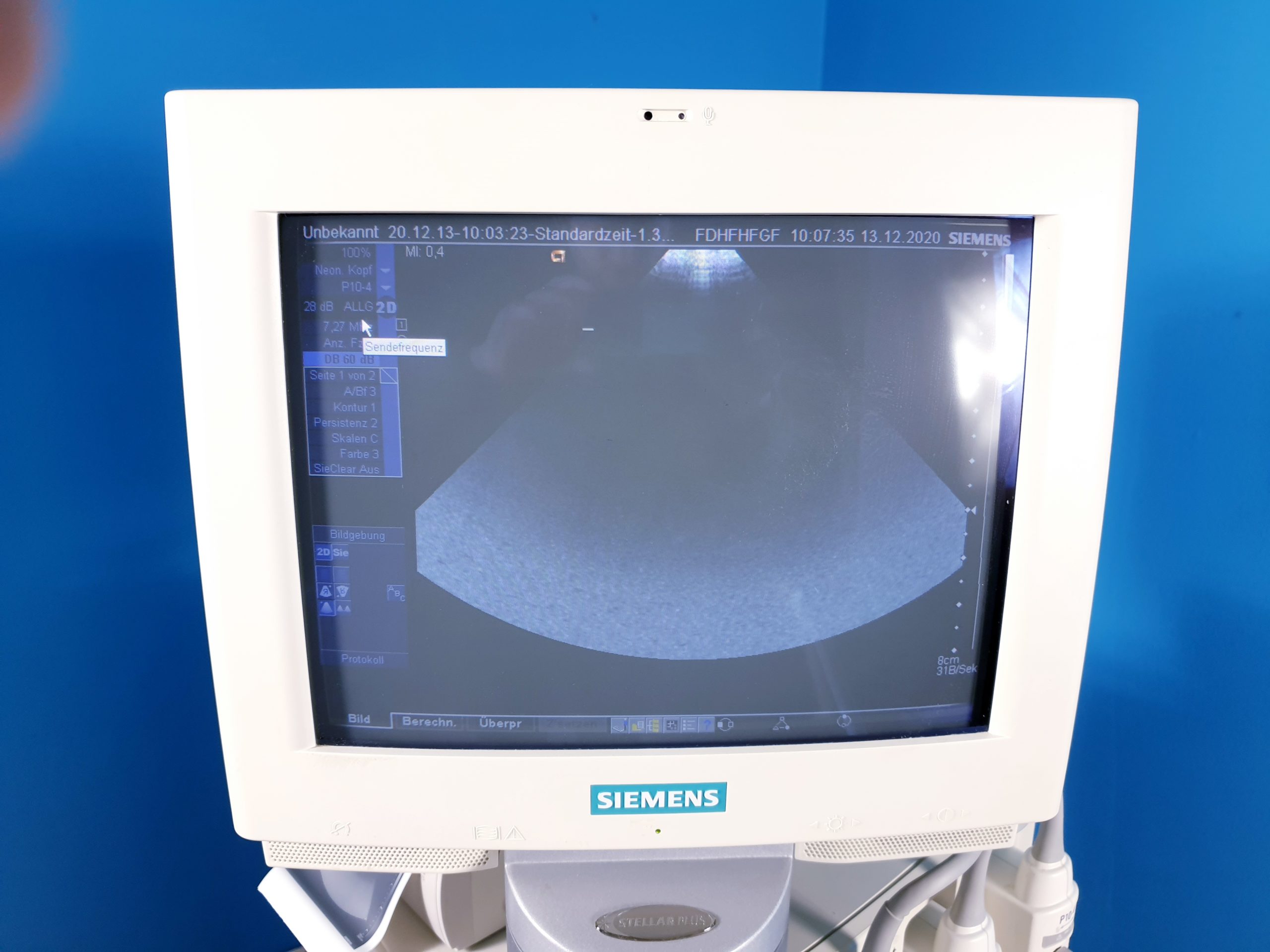 Siemens Sonoline Antares P10-4 , VFX9-4 , EC9-4 , CH6-2 Ultraschallgerät Doppler, … thumbnail 4