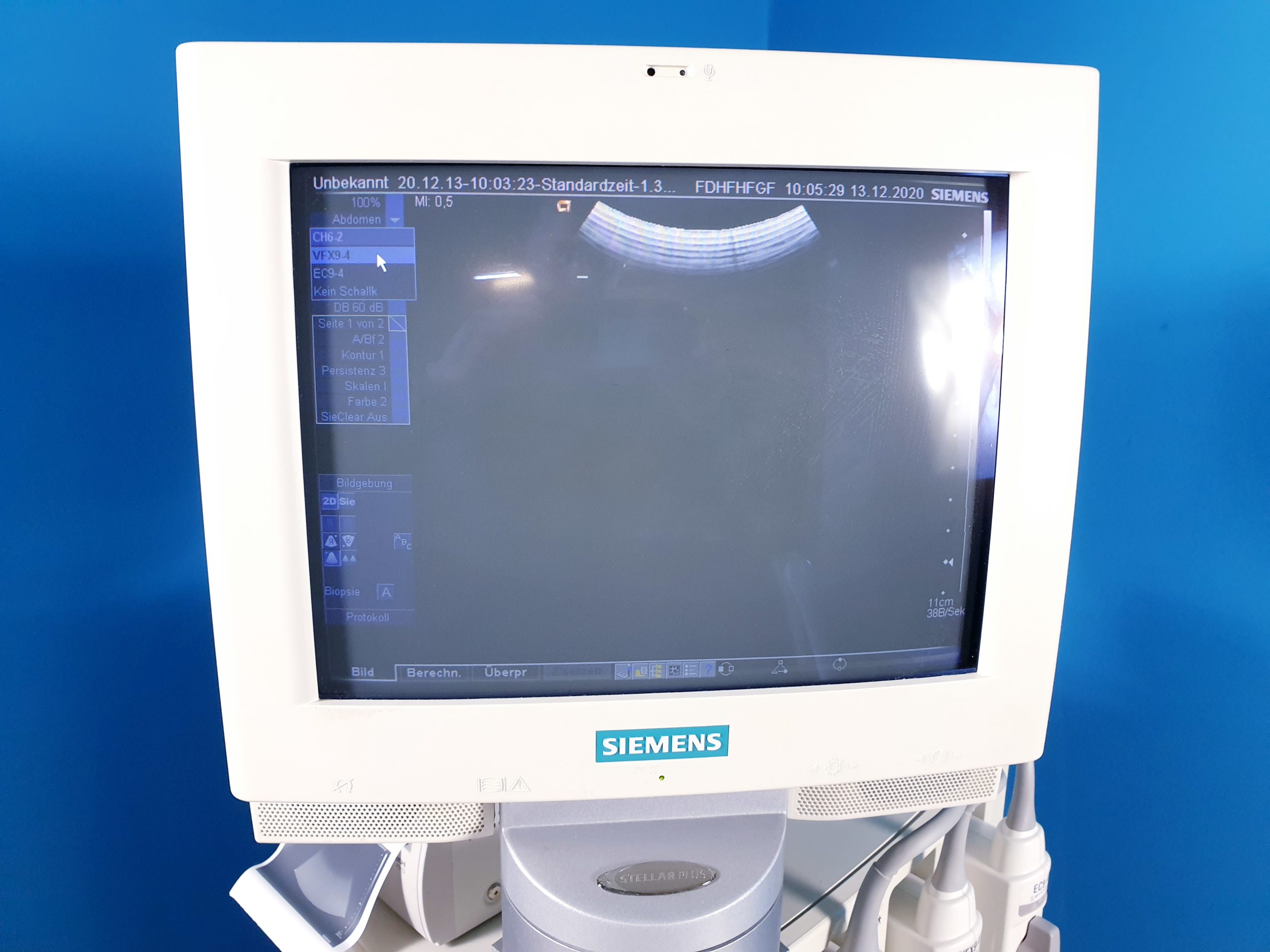 Siemens Sonoline Antares P10-4 , VFX9-4 , EC9-4 , CH6-2 Ultraschallgerät Doppler, … thumbnail 6
