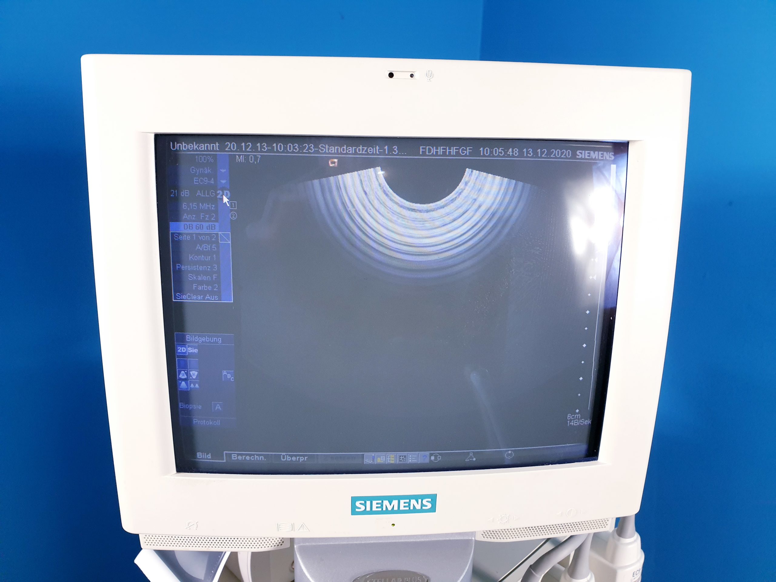 Siemens Sonoline Antares P10-4 , VFX9-4 , EC9-4 , CH6-2 Ultraschallgerät Doppler, … thumbnail 7