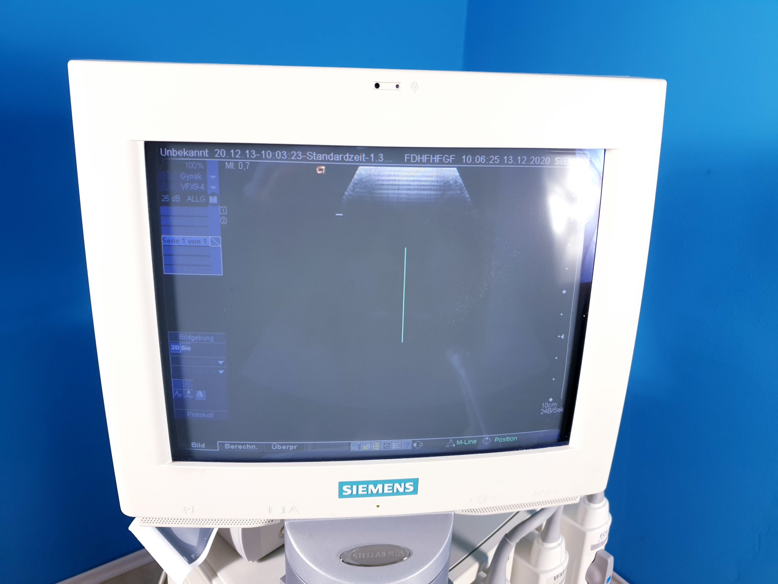 Siemens Sonoline Antares P10-4 , VFX9-4 , EC9-4 , CH6-2 Ultraschallgerät Doppler, … thumbnail 9