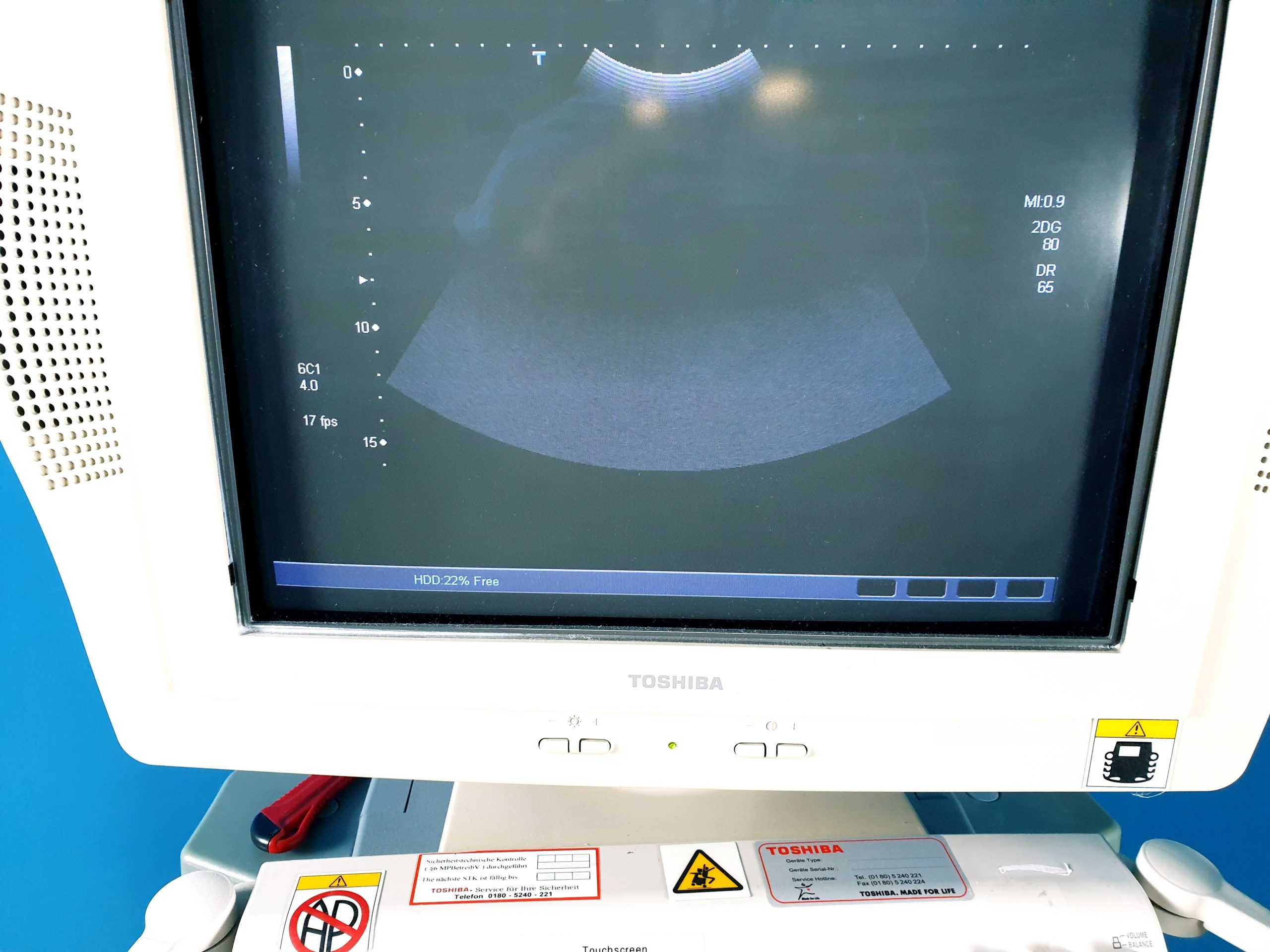 Toshiba SSA-770A Aplio Ultrasound System mit 3 Transducer Probes thumbnail 3