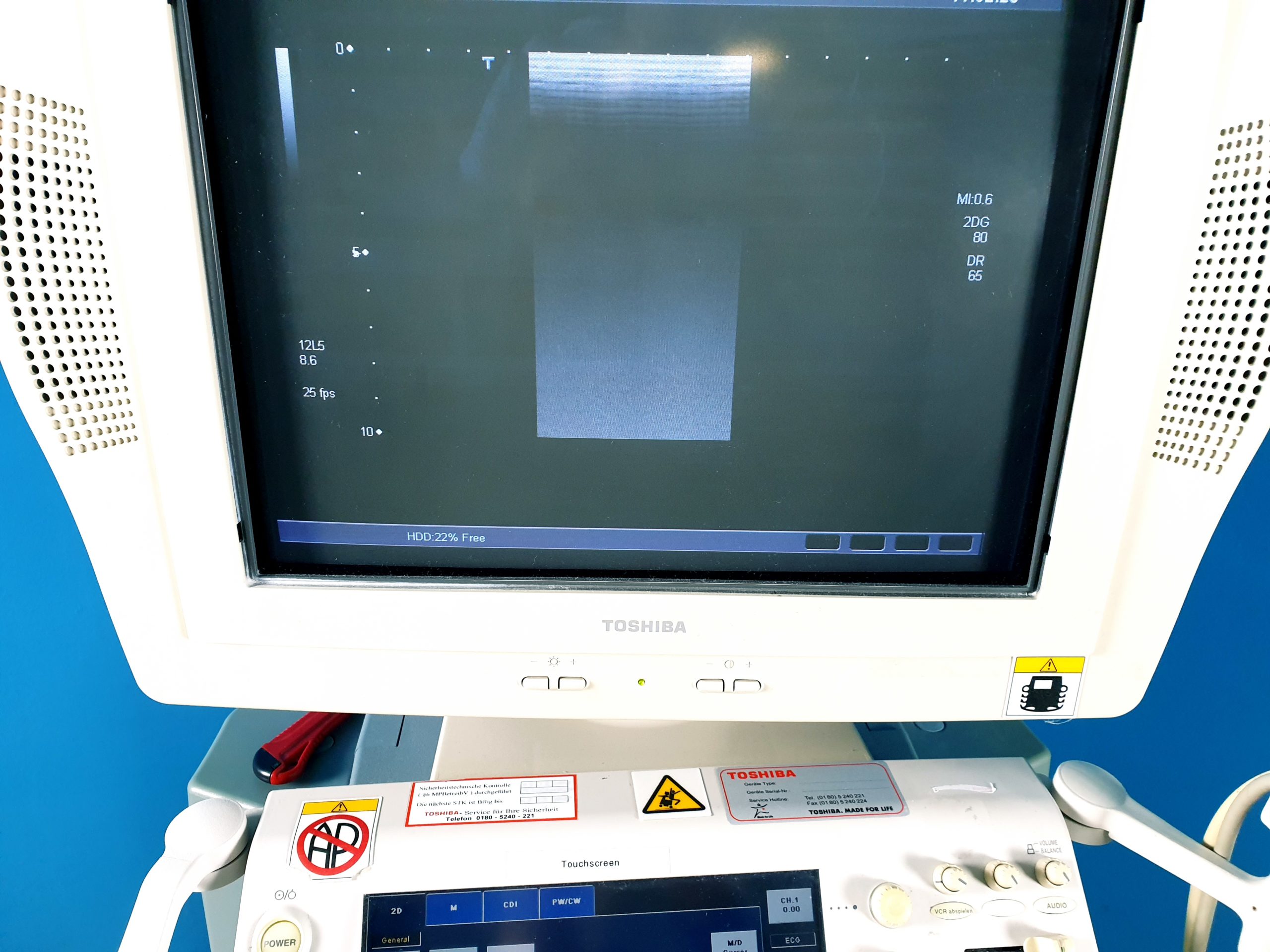 Toshiba SSA-770A Aplio Ultrasound System mit 3 Transducer Probes thumbnail 5
