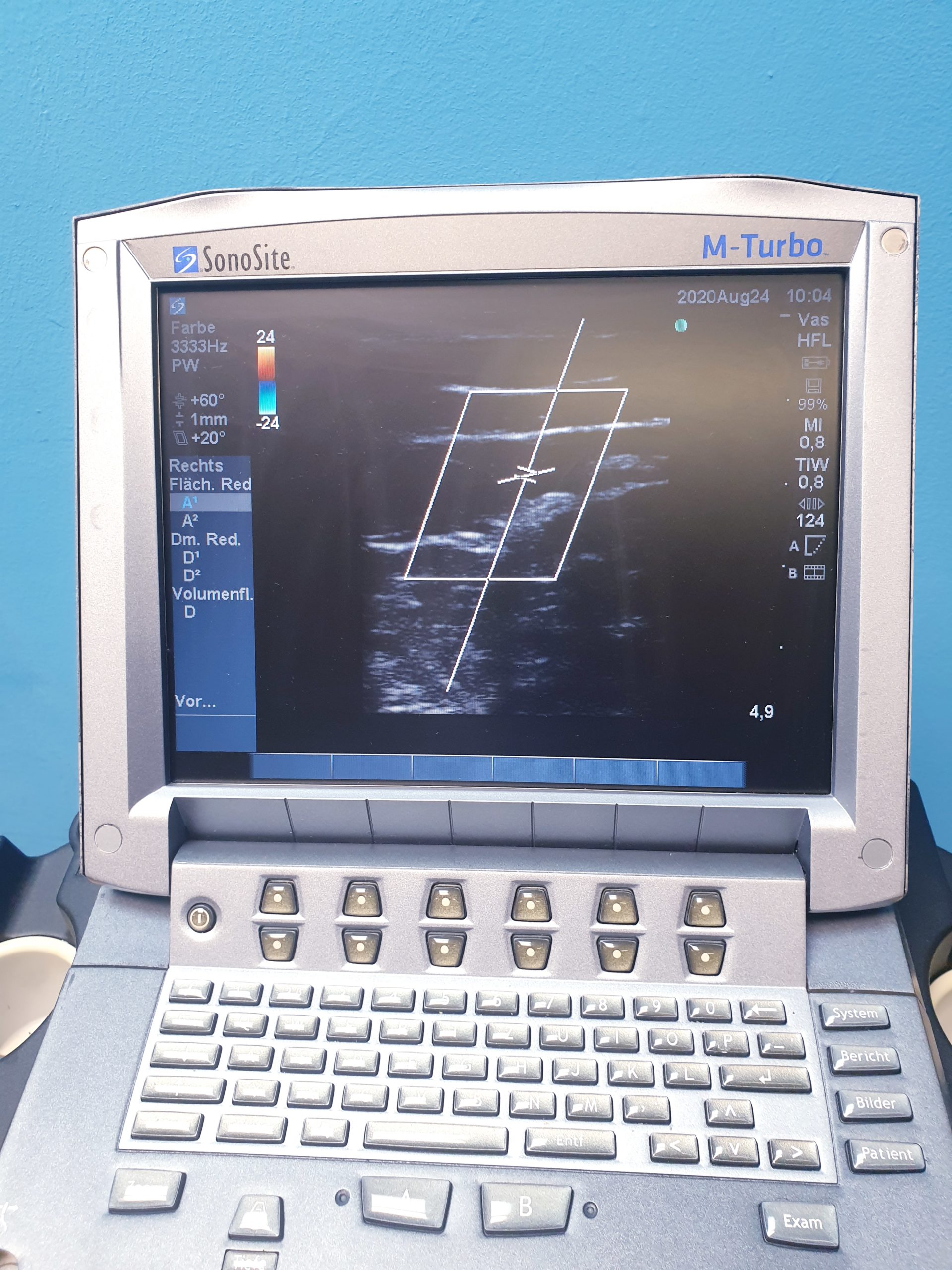 Sonosite M-Turbo Farbdoppler C60x/ 5-2MHz + HFL38X/13-6 & C60x/5-2 thumbnail 7