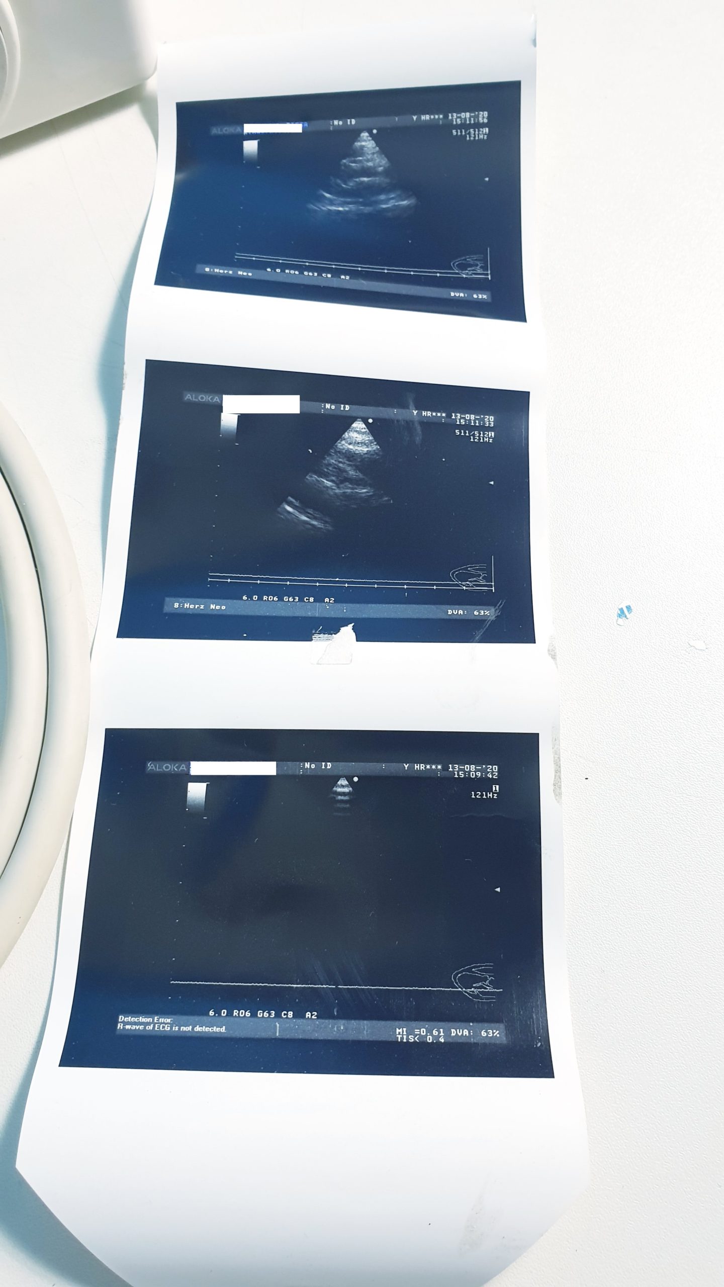 Aloka Ust-52108 // UST 52108 Cardiac Transducer|SSD-5000|SSD-5500 Sv|Alpha 5|Alpha 6|Alpha 7|Alpha 10 — image 1 of 2