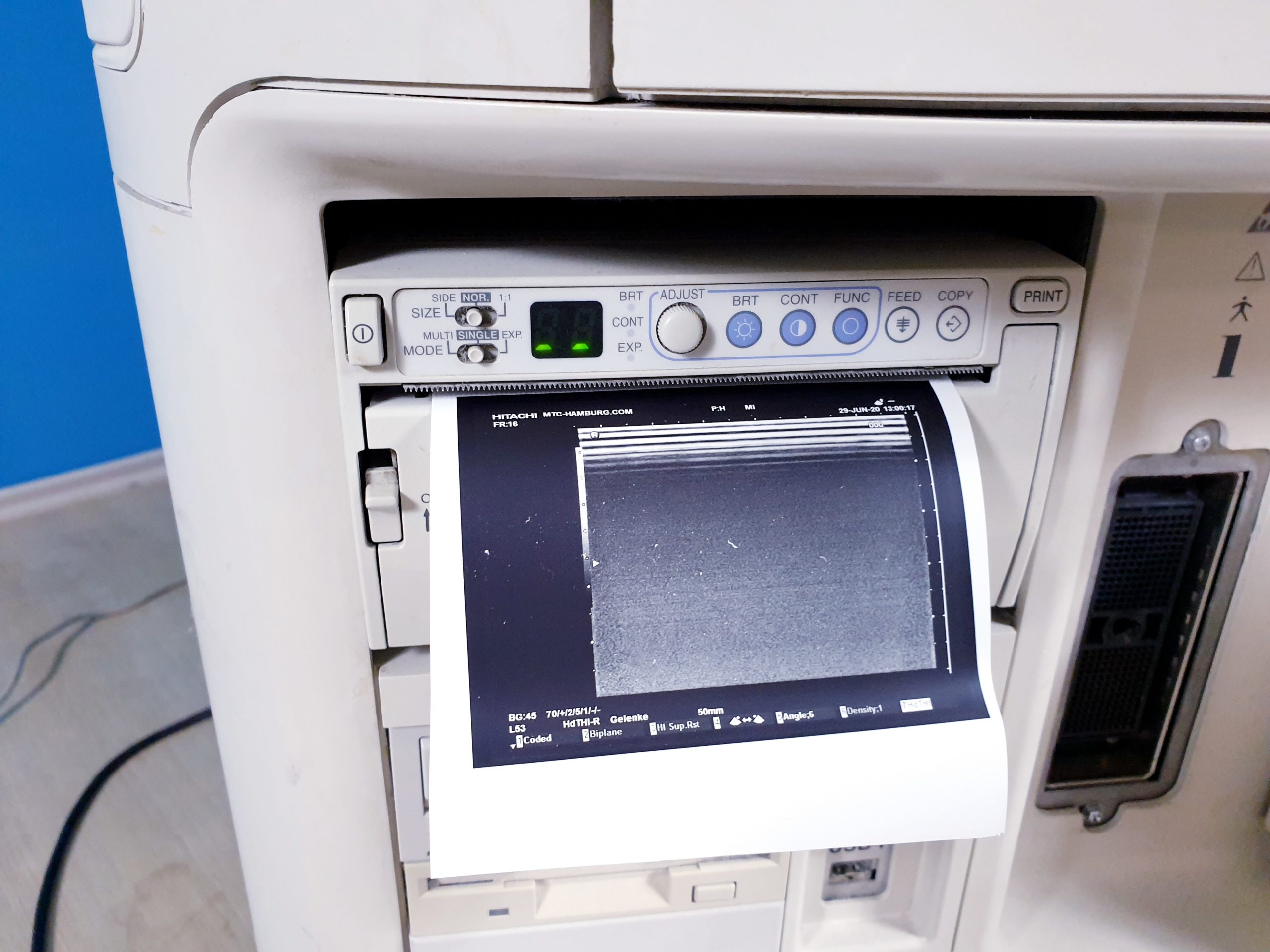 HITACHI HI VISION 900 Ultraschallgerät mit 03 Sonden DOM2008 thumbnail 5