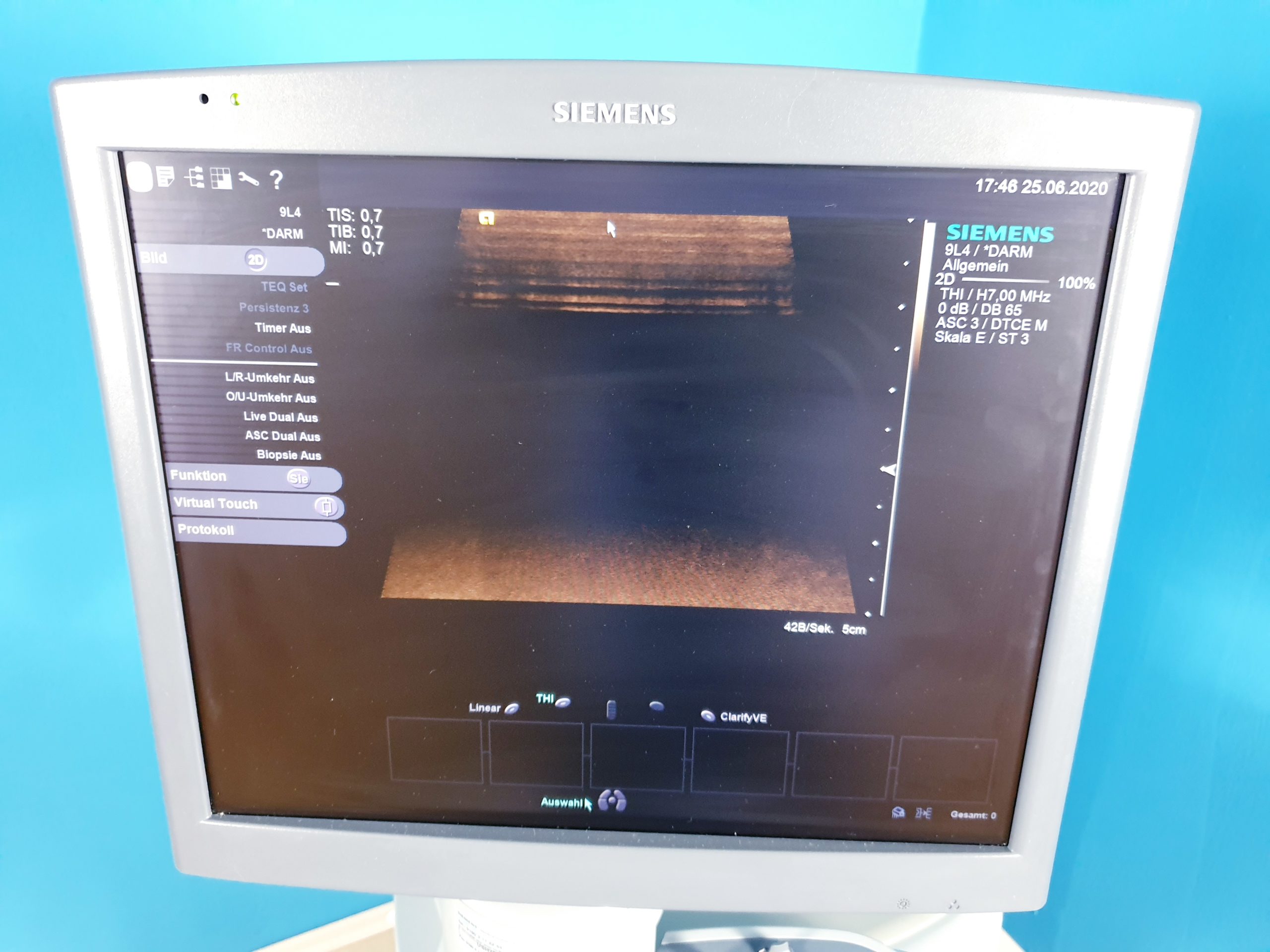 Siemens Acuson S2000 Ultraschall 4C1 9L4 14L5 Sonden Transducer DOM2009 thumbnail 8