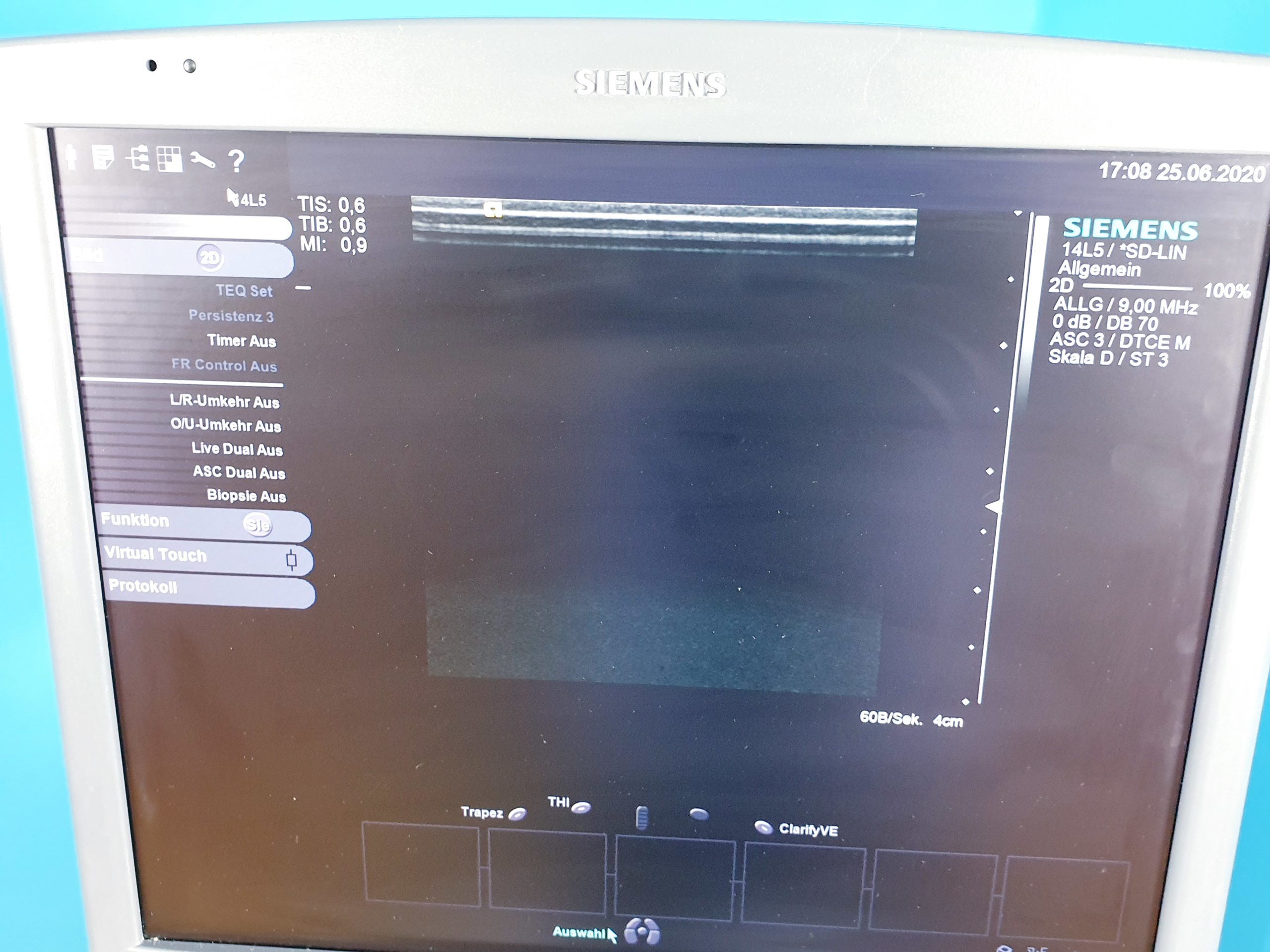 Siemens Acuson S2000 Ultraschall 4C1 9L4 14L5 Sonden Transducer DOM2009 thumbnail 10