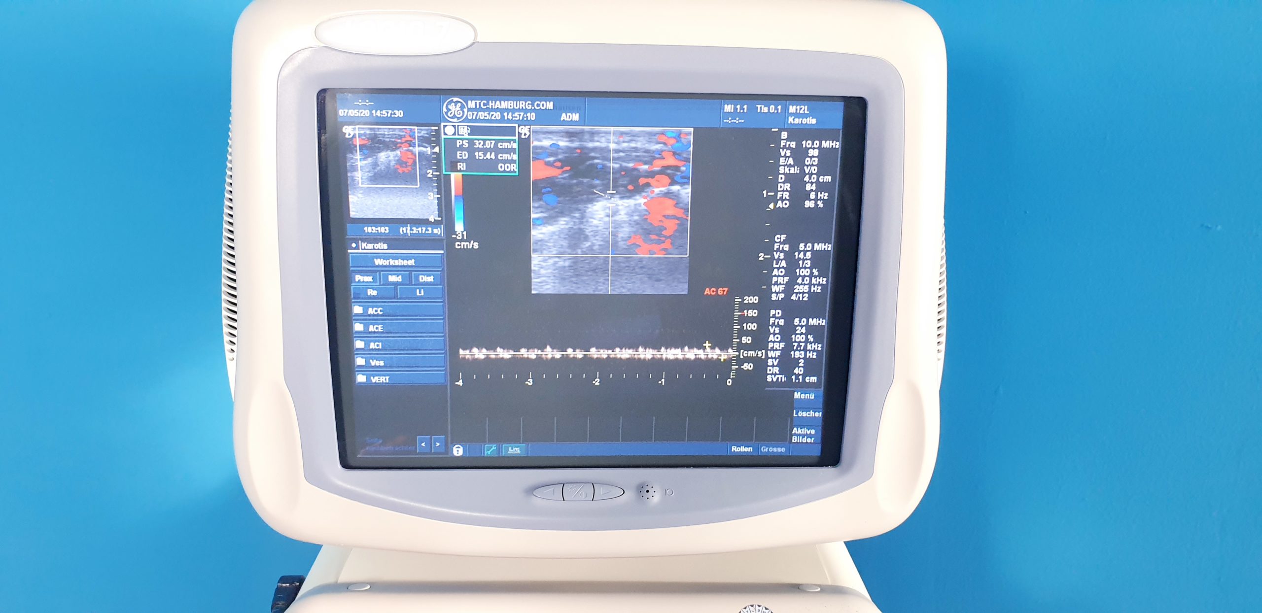 GE Logic 7 mit 3.5C konvex Sonde und M12L Linear-Sonde Doppler, … – johanniter – faten torjmen mkacher thumbnail 3