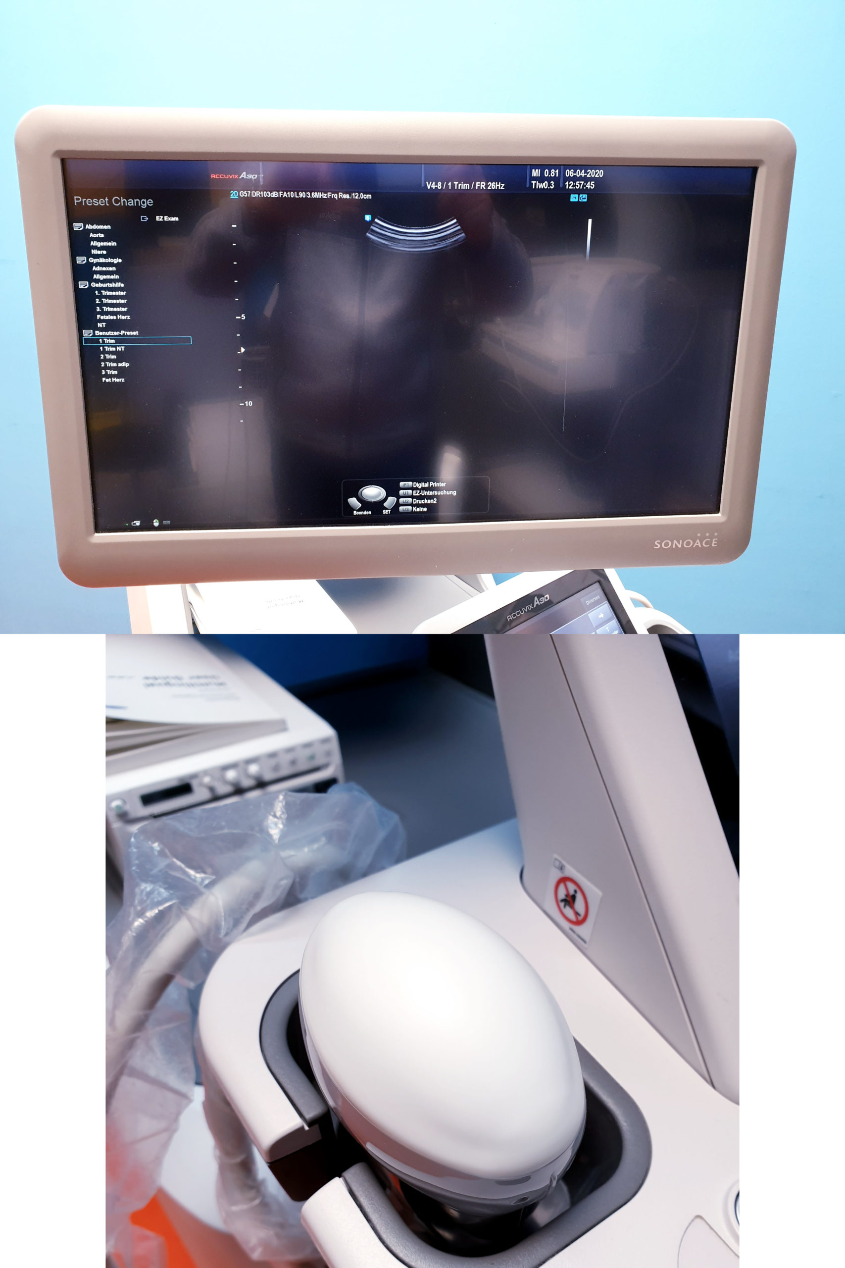 Samsung Sonoace ACCUVIX A30 // A 30 3D/4D V4-8 3D Sonde L5-13S UND EC4-9IS DOM 2014 thumbnail 3