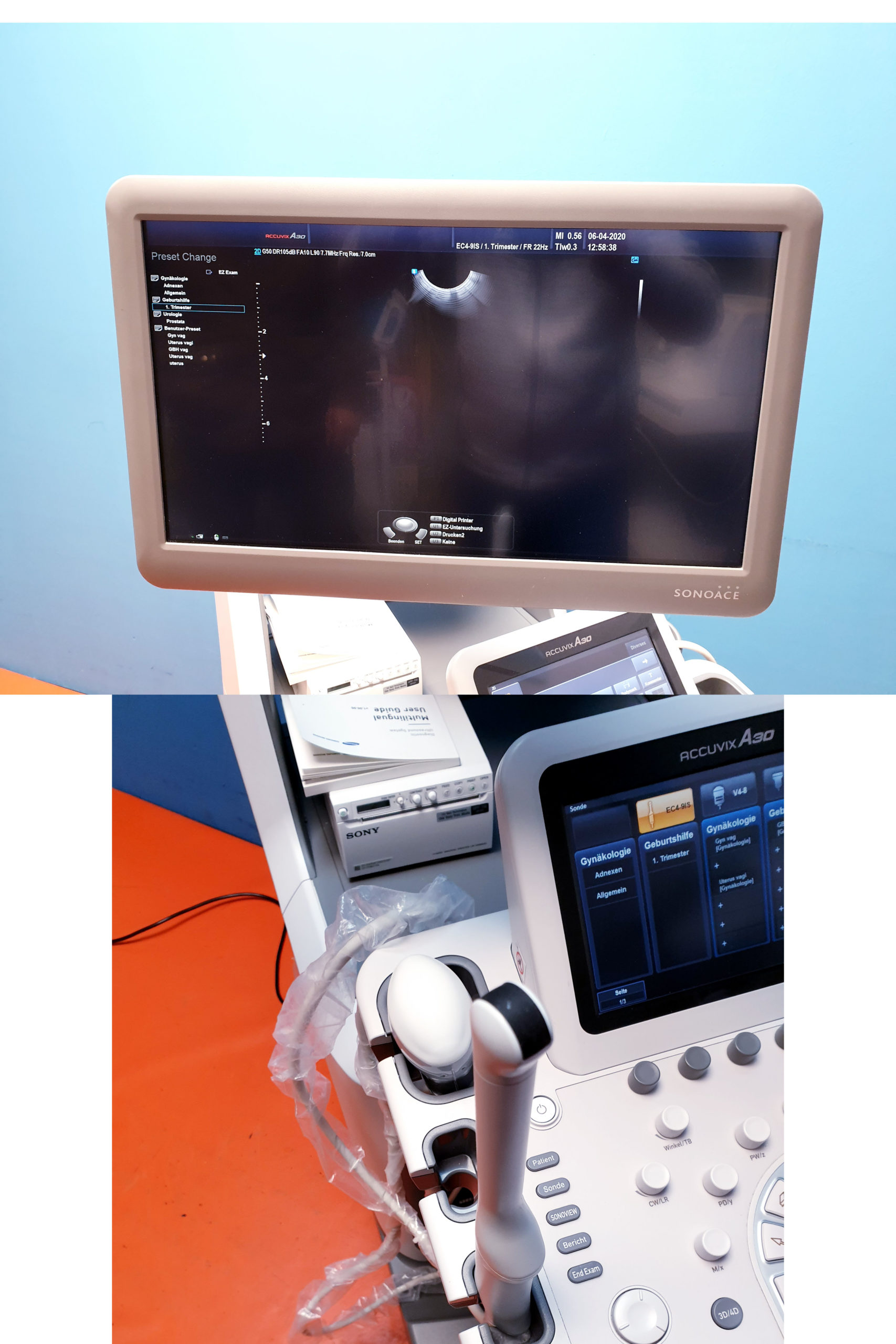 Samsung Sonoace ACCUVIX A30 // A 30 3D/4D V4-8 3D Sonde L5-13S UND EC4-9IS DOM 2014 thumbnail 6