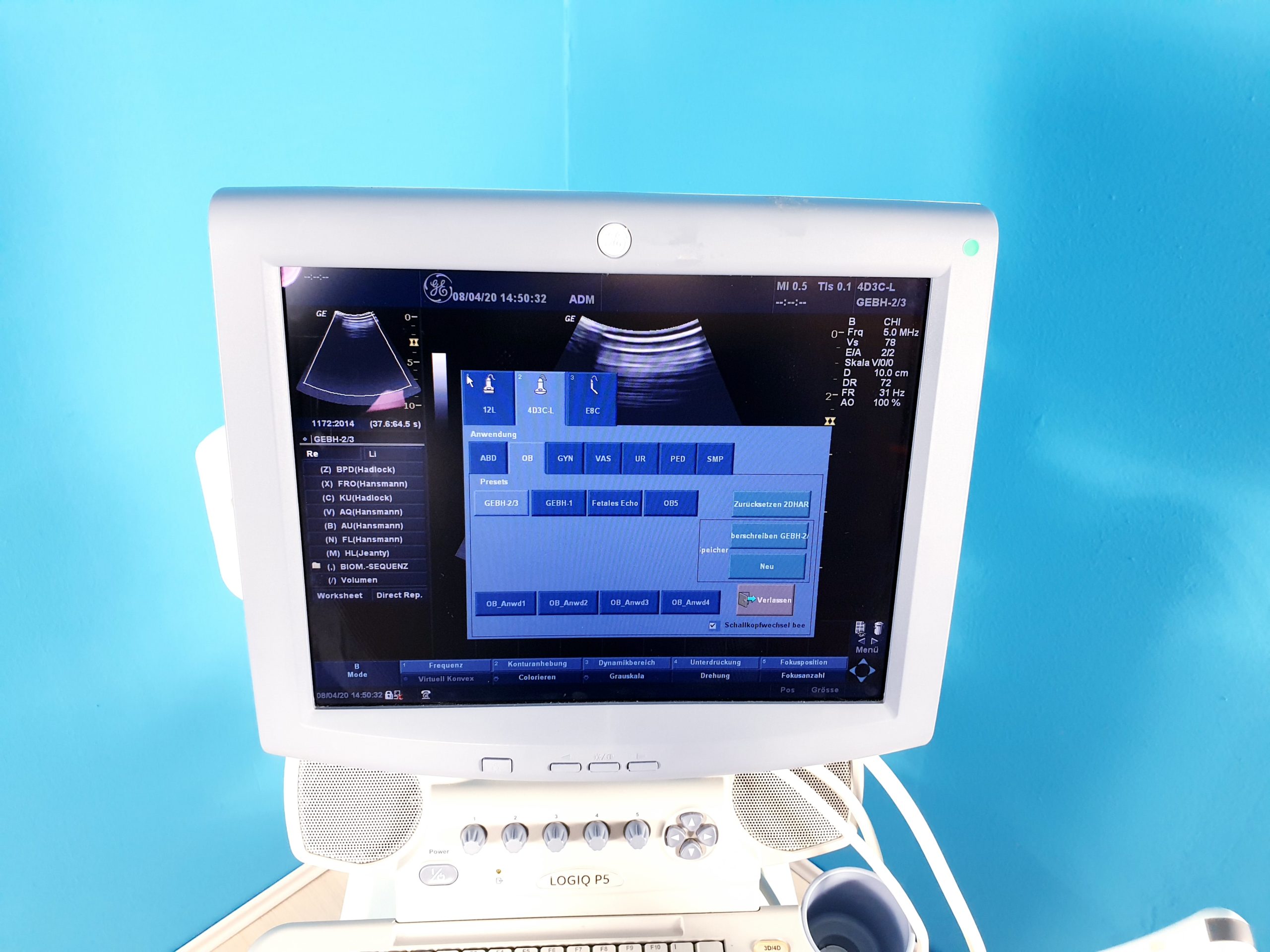 GE LOGIQ P5 Gynäkologie mit 3D/4D Sonde Linear, Endovaginal + Printer BT08 thumbnail 4