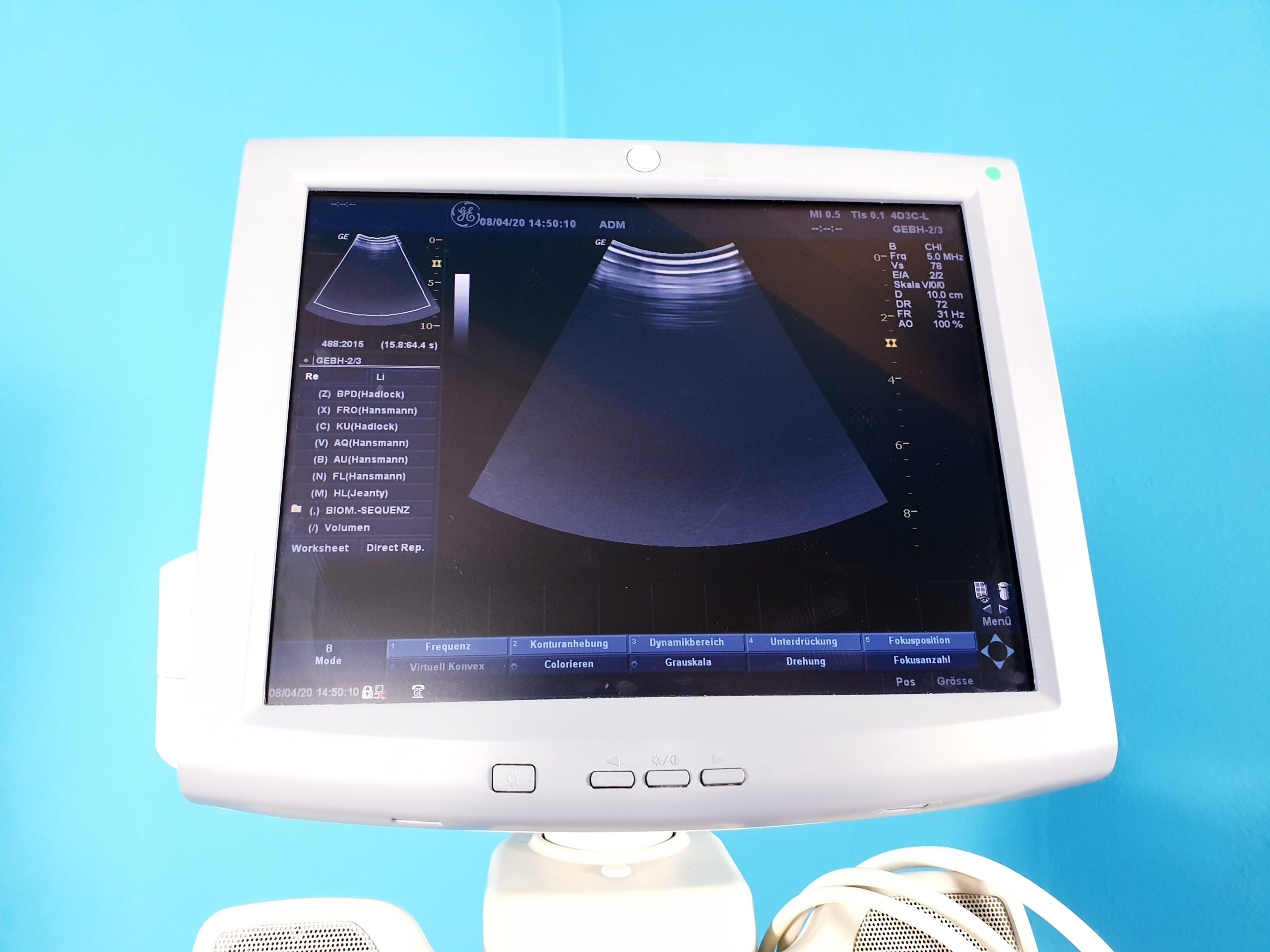 GE LOGIQ P5 Gynäkologie mit 3D/4D Sonde Linear, Endovaginal + Printer BT08 thumbnail 8