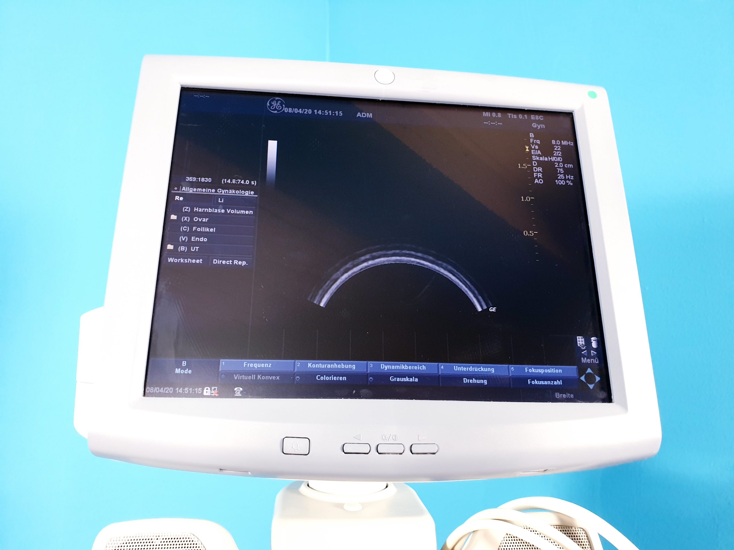 GE LOGIQ P5 Gynäkologie mit 3D/4D Sonde Linear, Endovaginal + Printer BT08 thumbnail 10