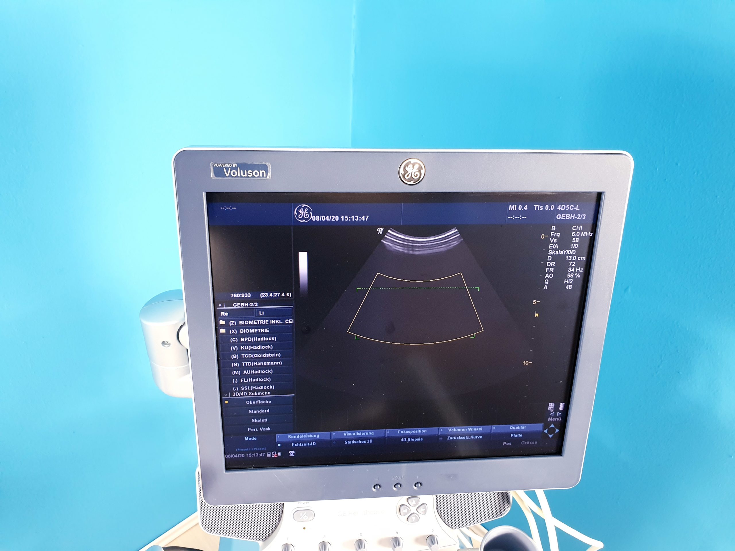 GE Logiq P6 Powered by Voluson Gynäkologie mit 3D/4D Sonde Linear, Endovaginal + Printer thumbnail 4