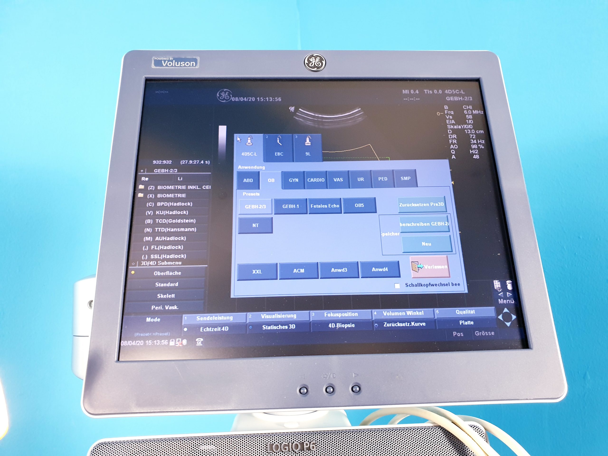 GE Logiq P6 Powered by Voluson Gynäkologie mit 3D/4D Sonde Linear, Endovaginal + Printer thumbnail 5