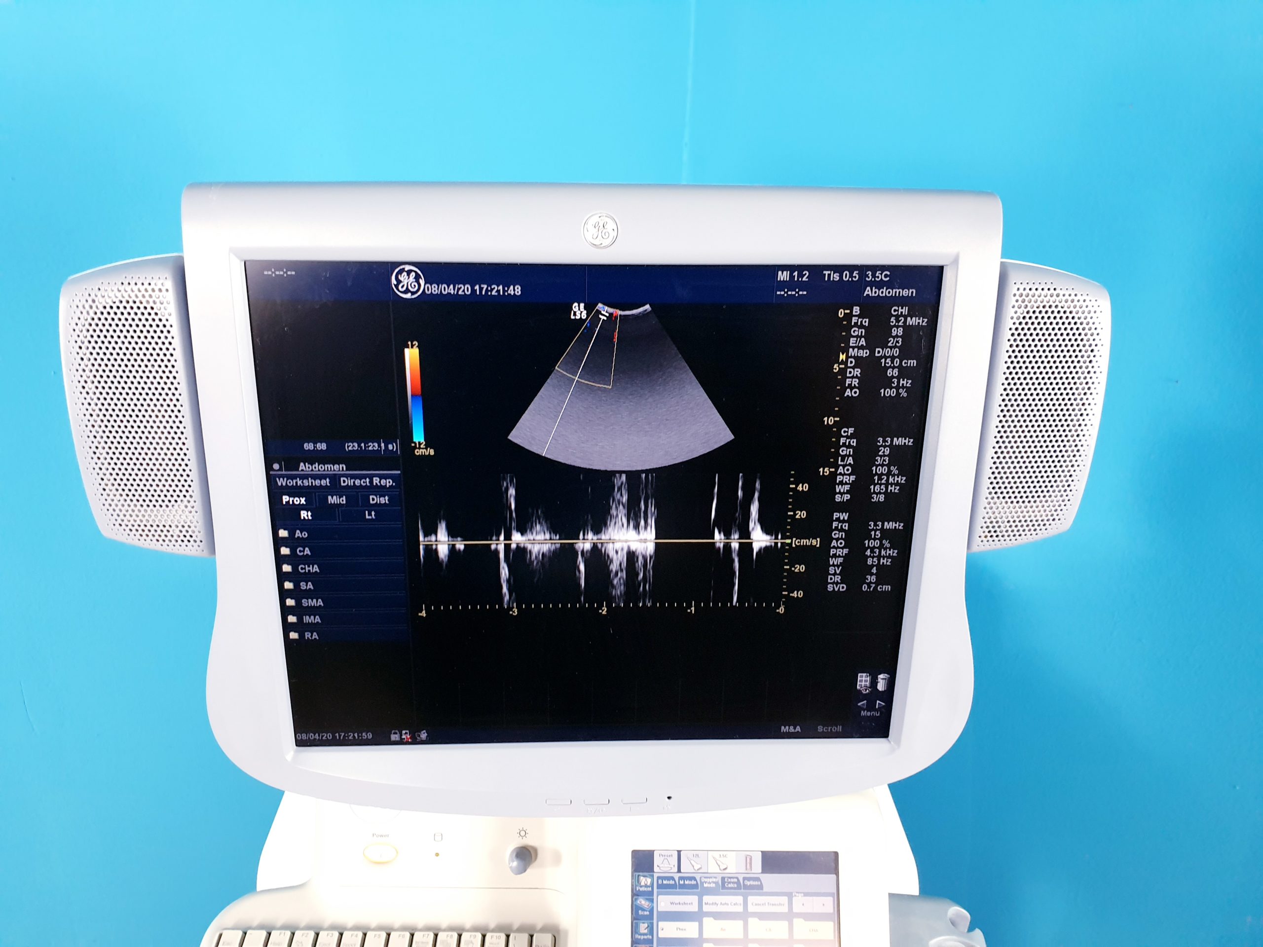 GE LOGIQ S6 // S 6 mit Konvex und Linear-Sonde — image 1 of 8