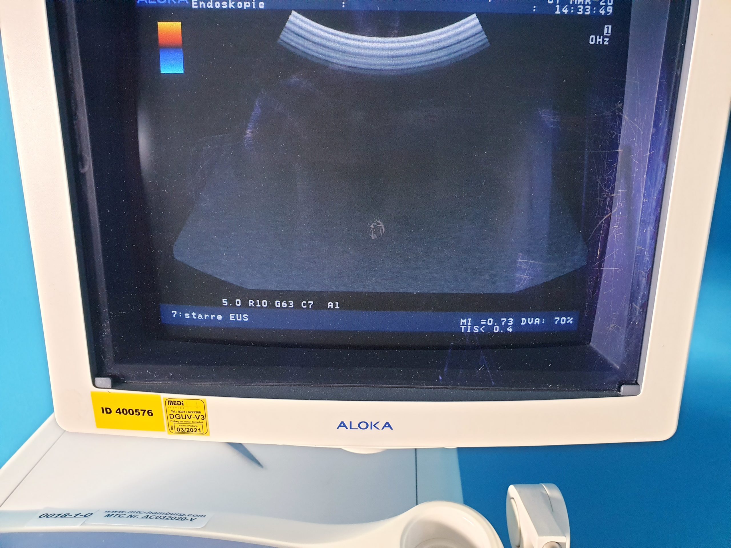 Aloka Prosound Alpha 5 SV Ultraschallgerät mit Konvex, Printer thumbnail 3