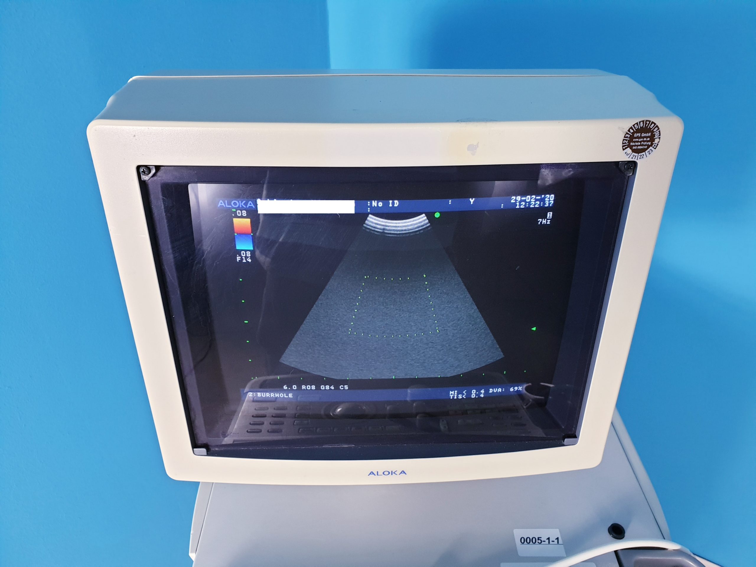 ALOKA SSD-4000 PLUS Ultraschallgerät mit 7.5 und 5 Mhz thumbnail 6