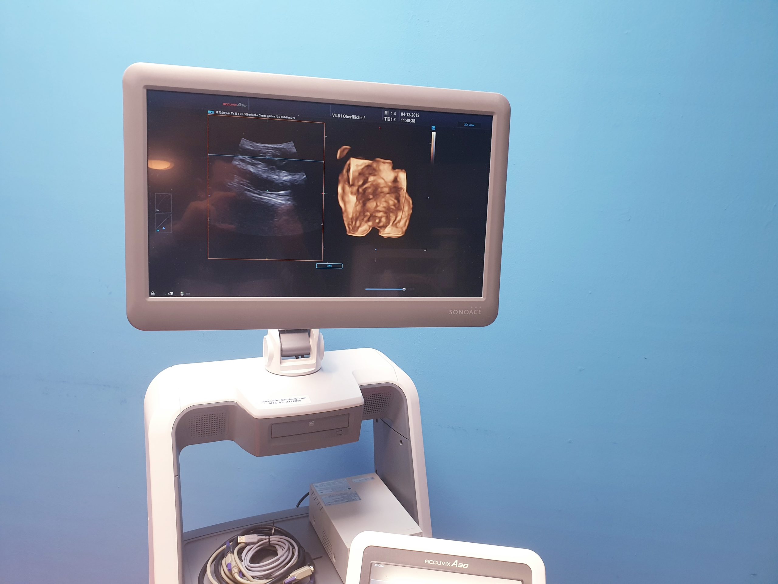 Samsung Sonoace ACCUVIX A30 // A 30 3D/4D V4-8 3D Sonde L7-16IS UND ES4-9IS DOM 2013 — image 1 of 5