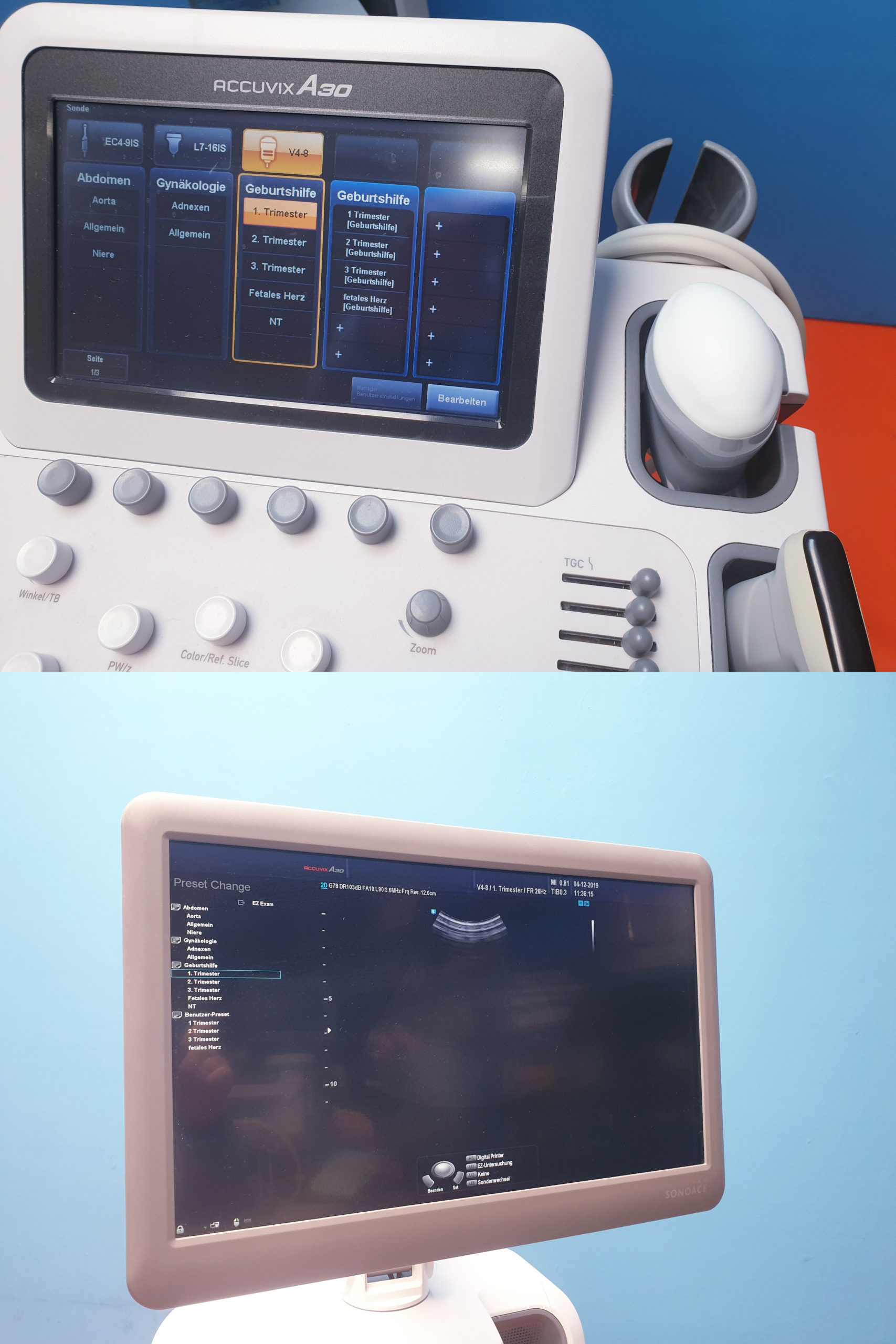 Samsung Sonoace ACCUVIX A30 // A 30 3D/4D V4-8 3D Sonde L7-16IS UND ES4-9IS DOM 2013 thumbnail 2