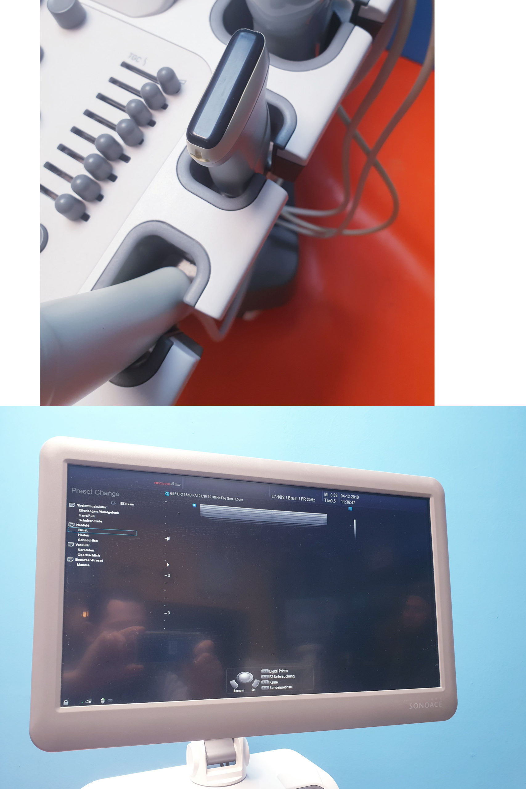 Samsung Sonoace ACCUVIX A30 // A 30 3D/4D V4-8 3D Sonde L7-16IS UND ES4-9IS DOM 2013 thumbnail 3