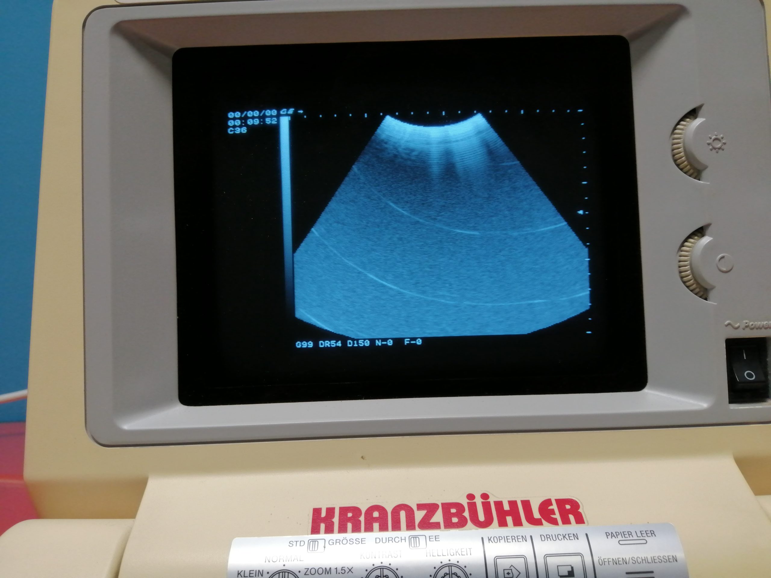 GE Logiq Alpha 100 mit Konvex und Endovaginale Sonde thumbnail 6
