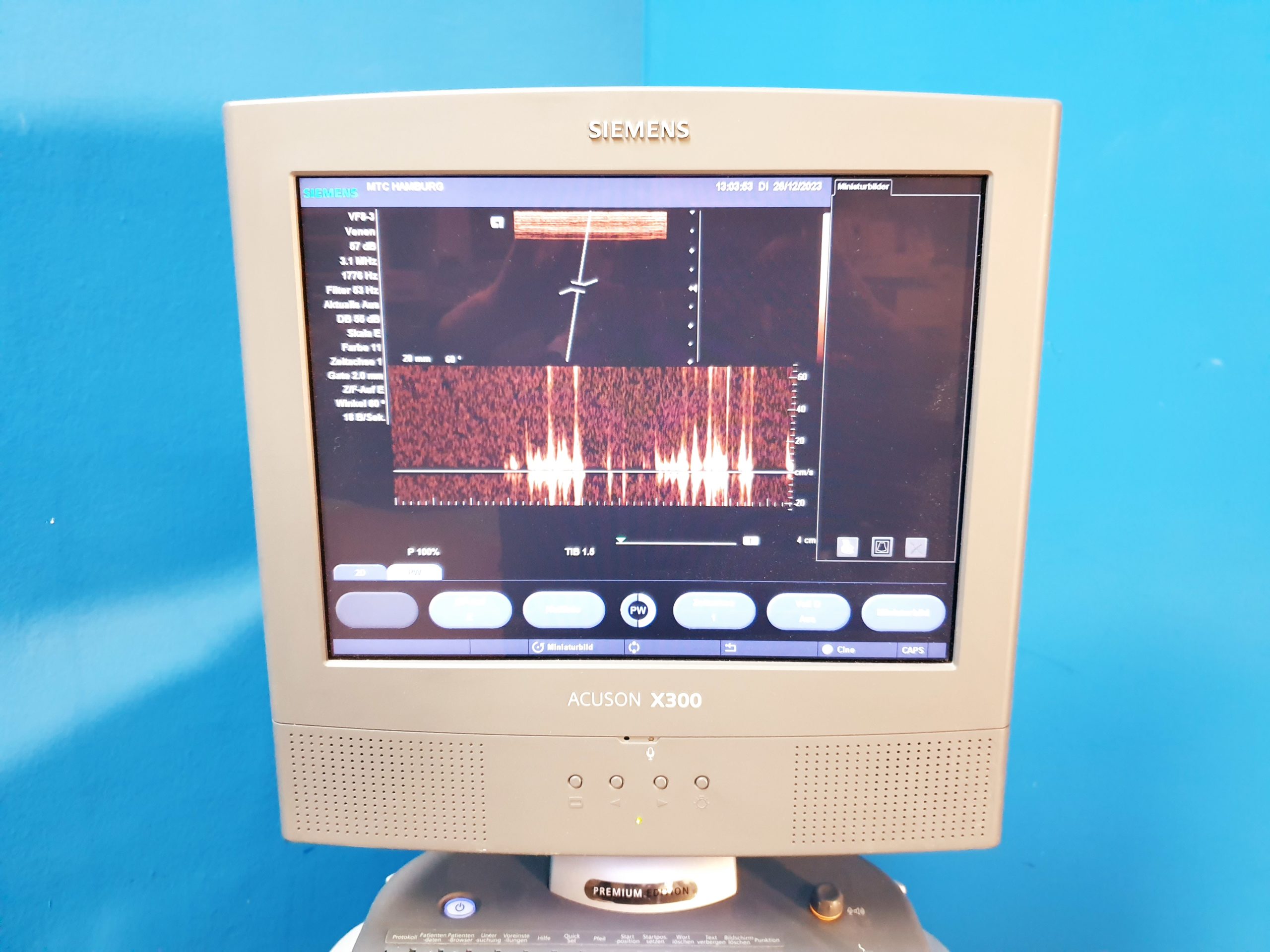 Siemens Acuson X300 // X 300 Premium Edition – Kardiomaschine thumbnail 3