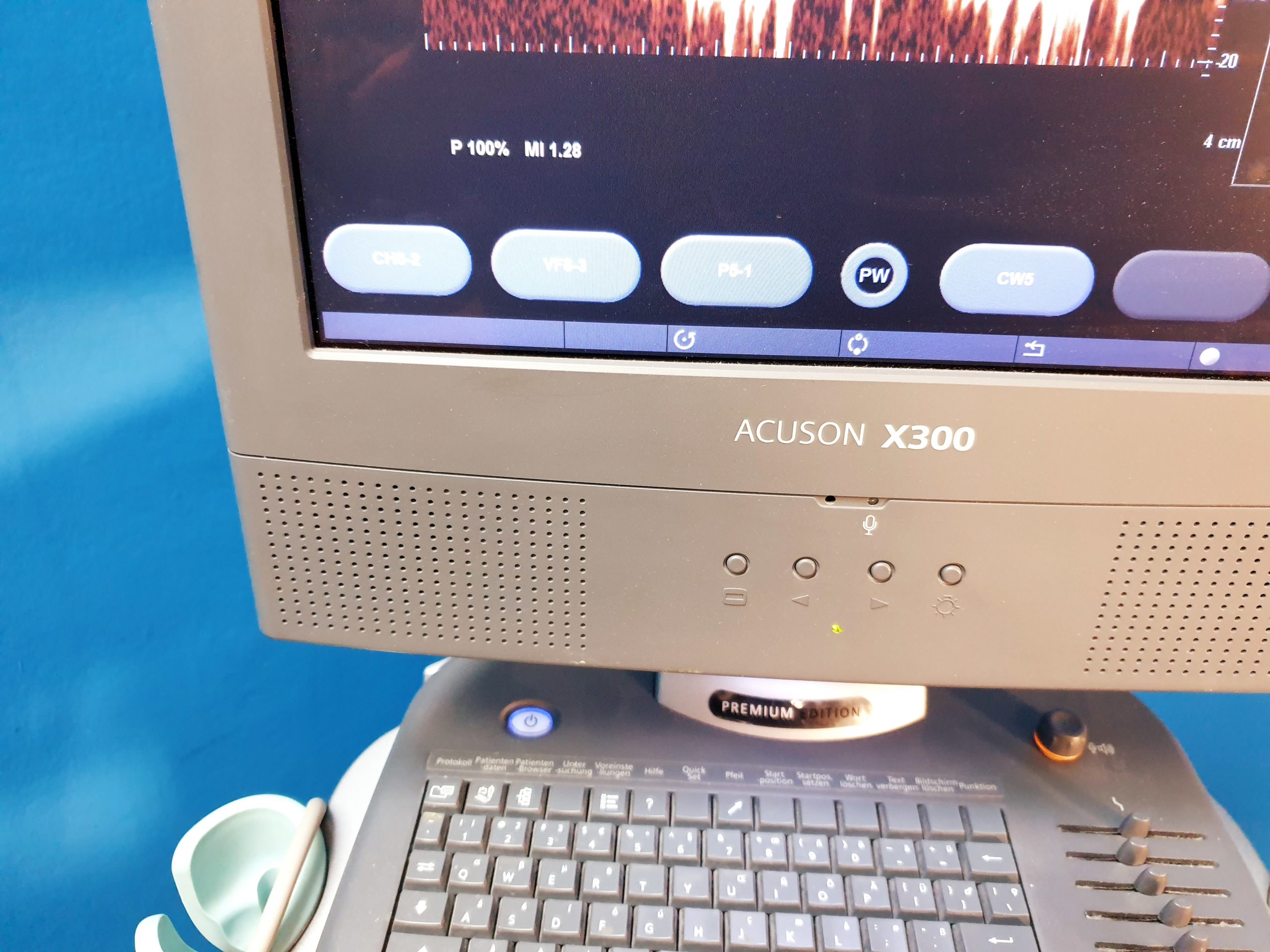 Siemens Acuson X300 // X 300 Premium Edition – Kardiomaschine thumbnail 4