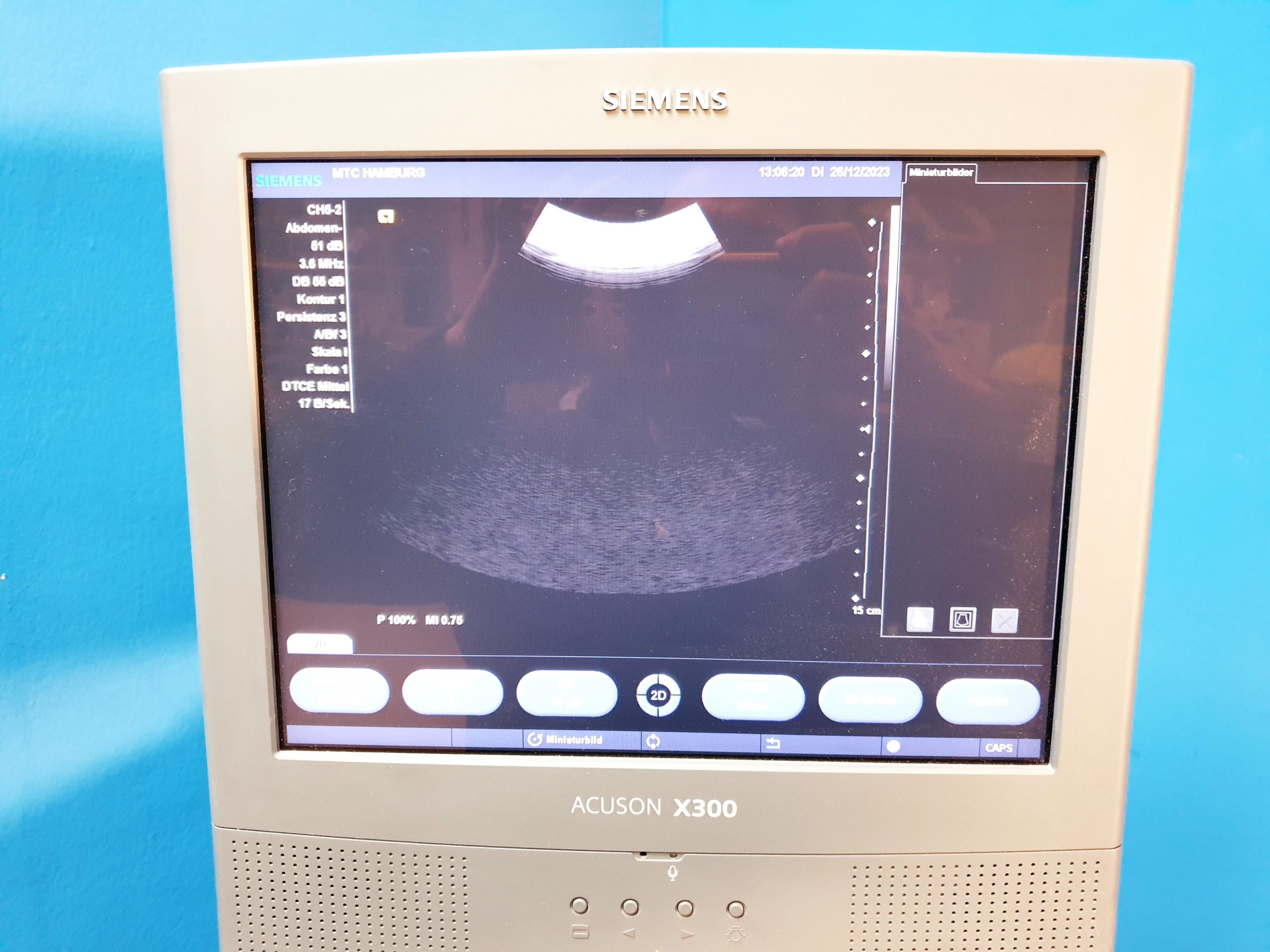 Siemens Acuson X300 // X 300 Premium Edition – Kardiomaschine thumbnail 6