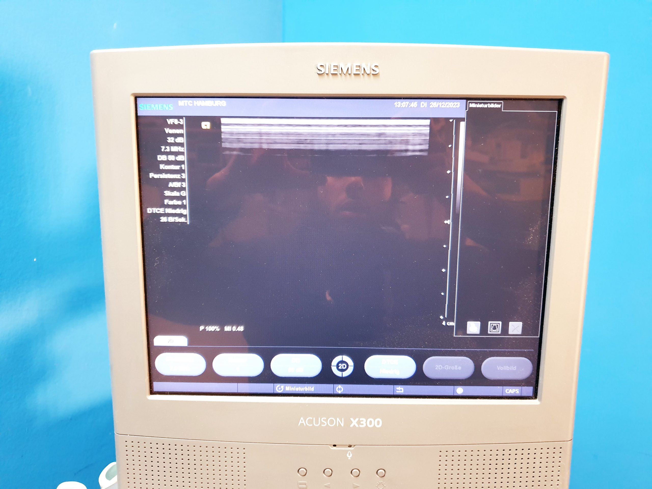Siemens Acuson X300 // X 300 Premium Edition – Kardiomaschine thumbnail 9
