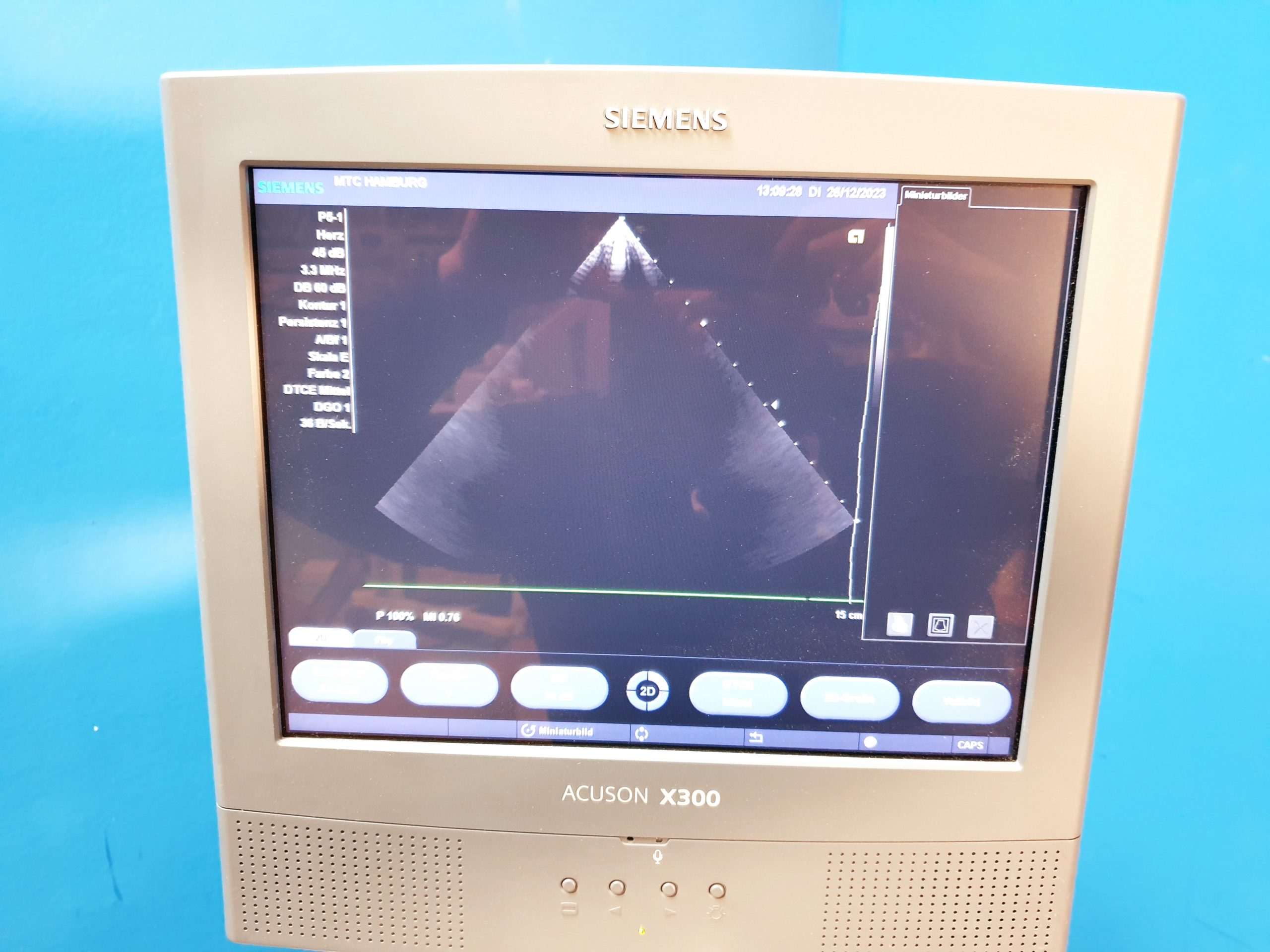 Siemens Acuson X300 // X 300 Premium Edition – Kardiomaschine thumbnail 13