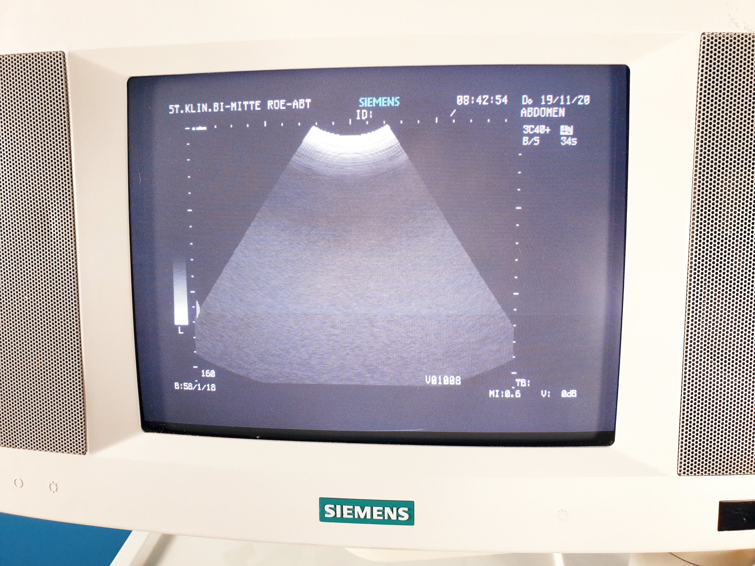 Siemens Versa Plus mit 02 Sonden – Doppler thumbnail 4