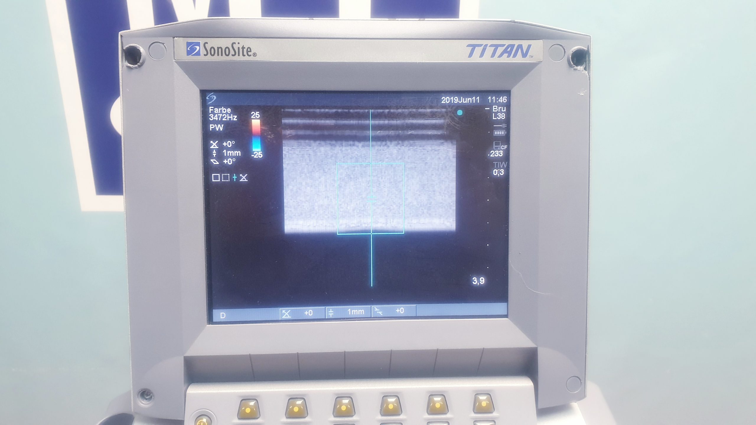 Sonosite MicroMaxx Farbdoppler mit Konvex und Linear thumbnail 3
