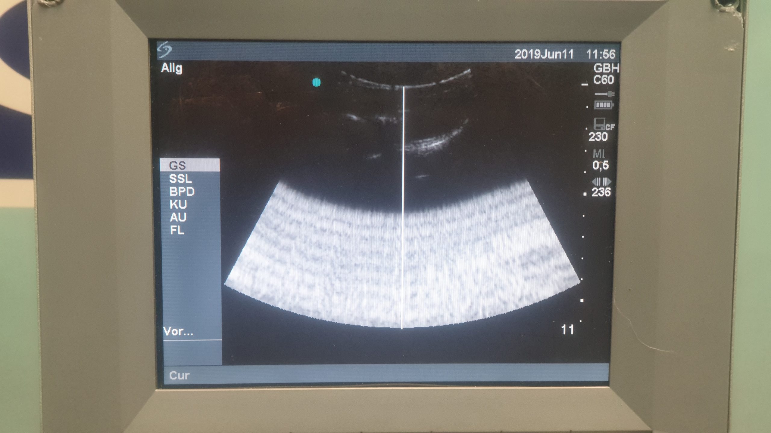 Sonosite MicroMaxx Farbdoppler mit Konvex und Linear thumbnail 6