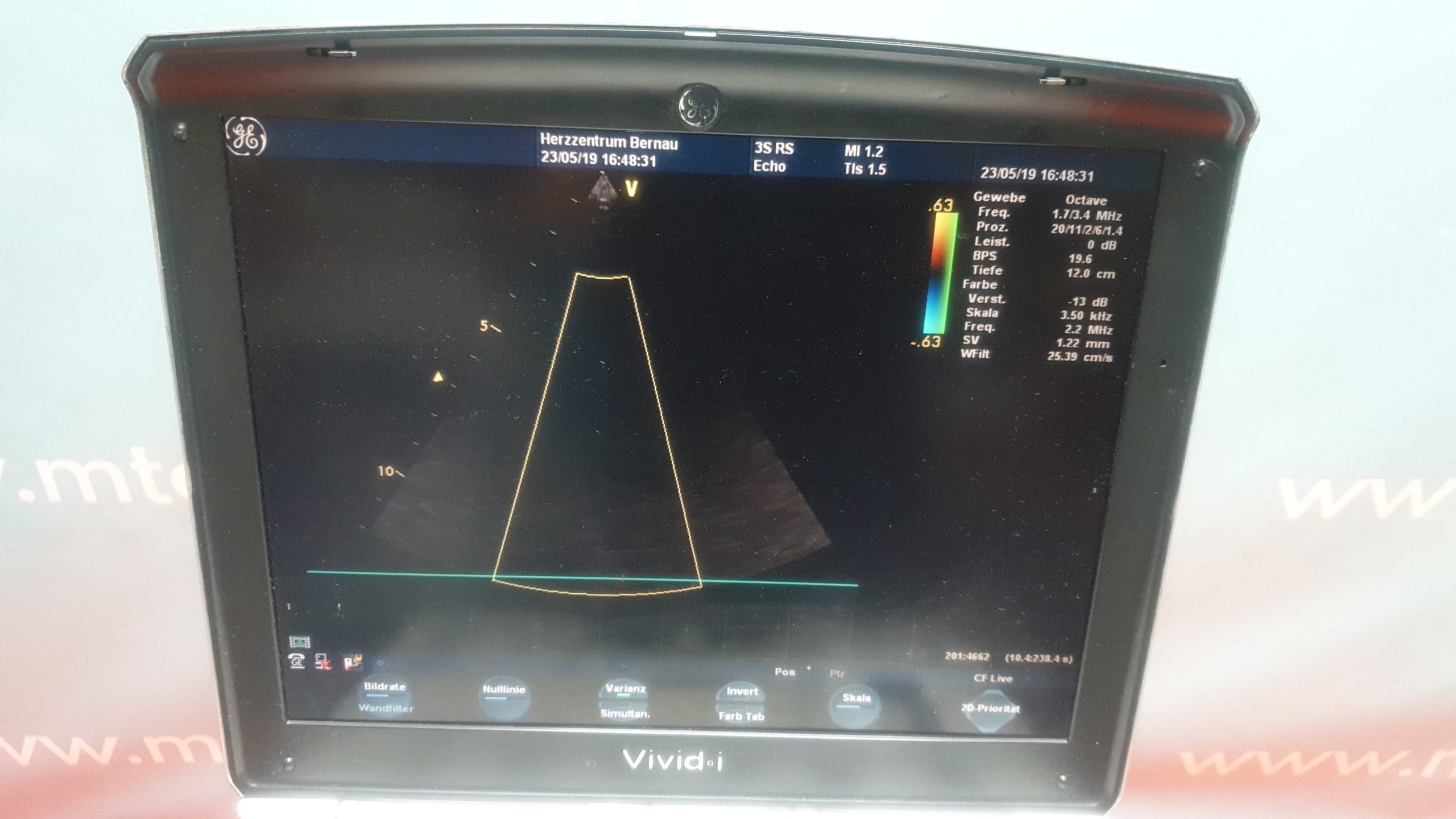GE VIVID i 3S-RS , 8L-RS + Gerätewagen thumbnail 3