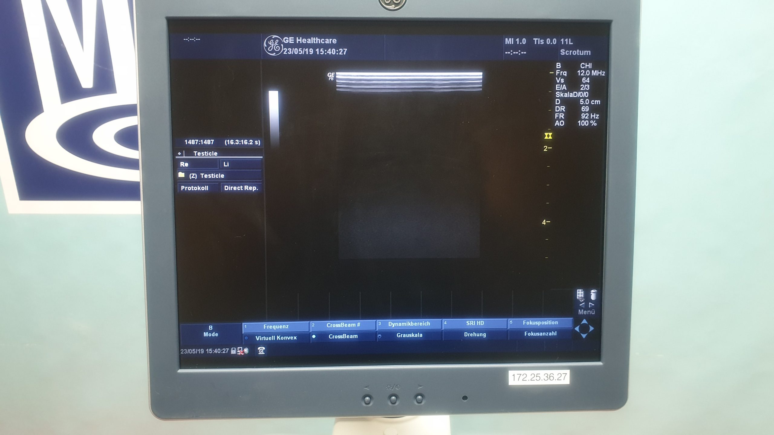 Ge Logiq P6 mit 4C , 11L , E8CS thumbnail 9