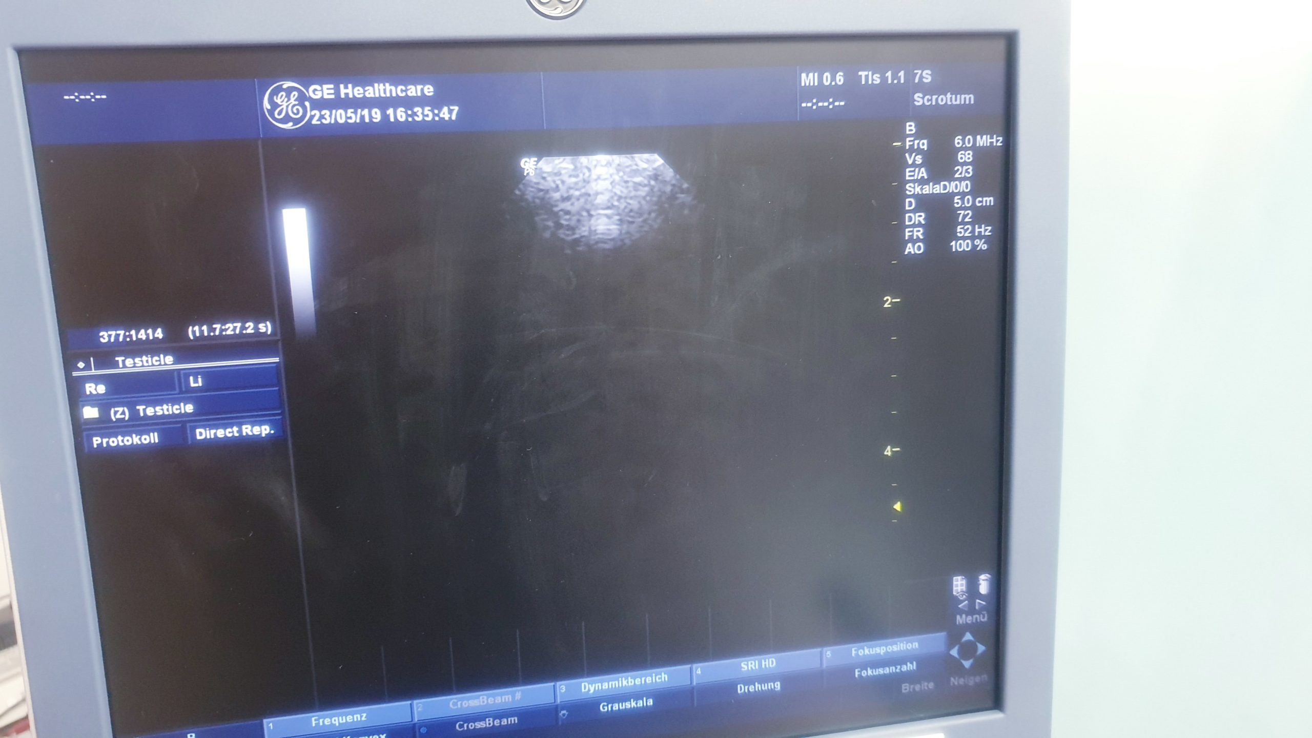 GE 7S Kardiosonde Ultraschallsonde , Kardio thumbnail 3