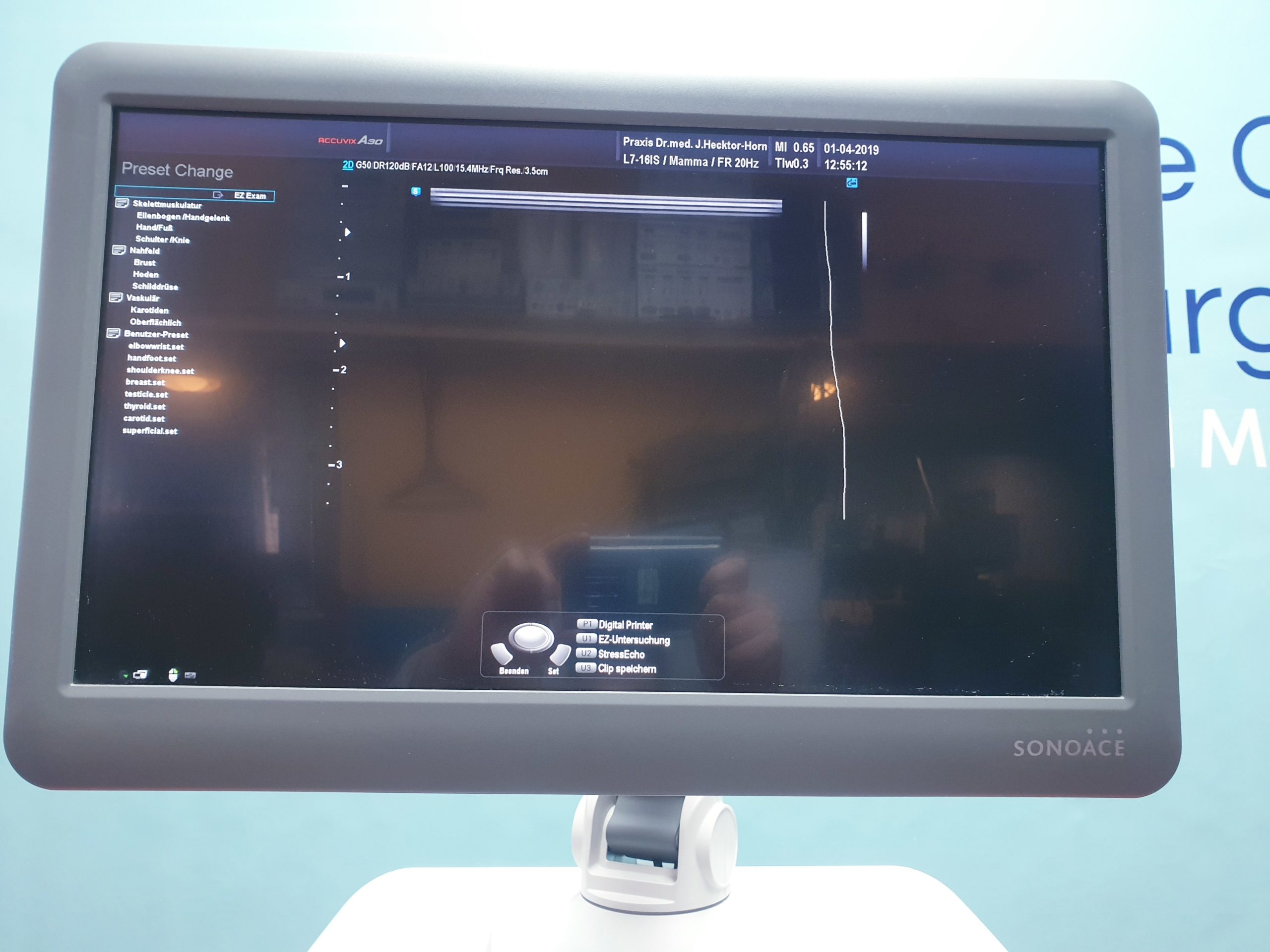 Samsung Sonoace A30 // A 30 3D/4D V4-8 3D Sonde + L7-16IS Linear Sonde DOM 2013 thumbnail 5