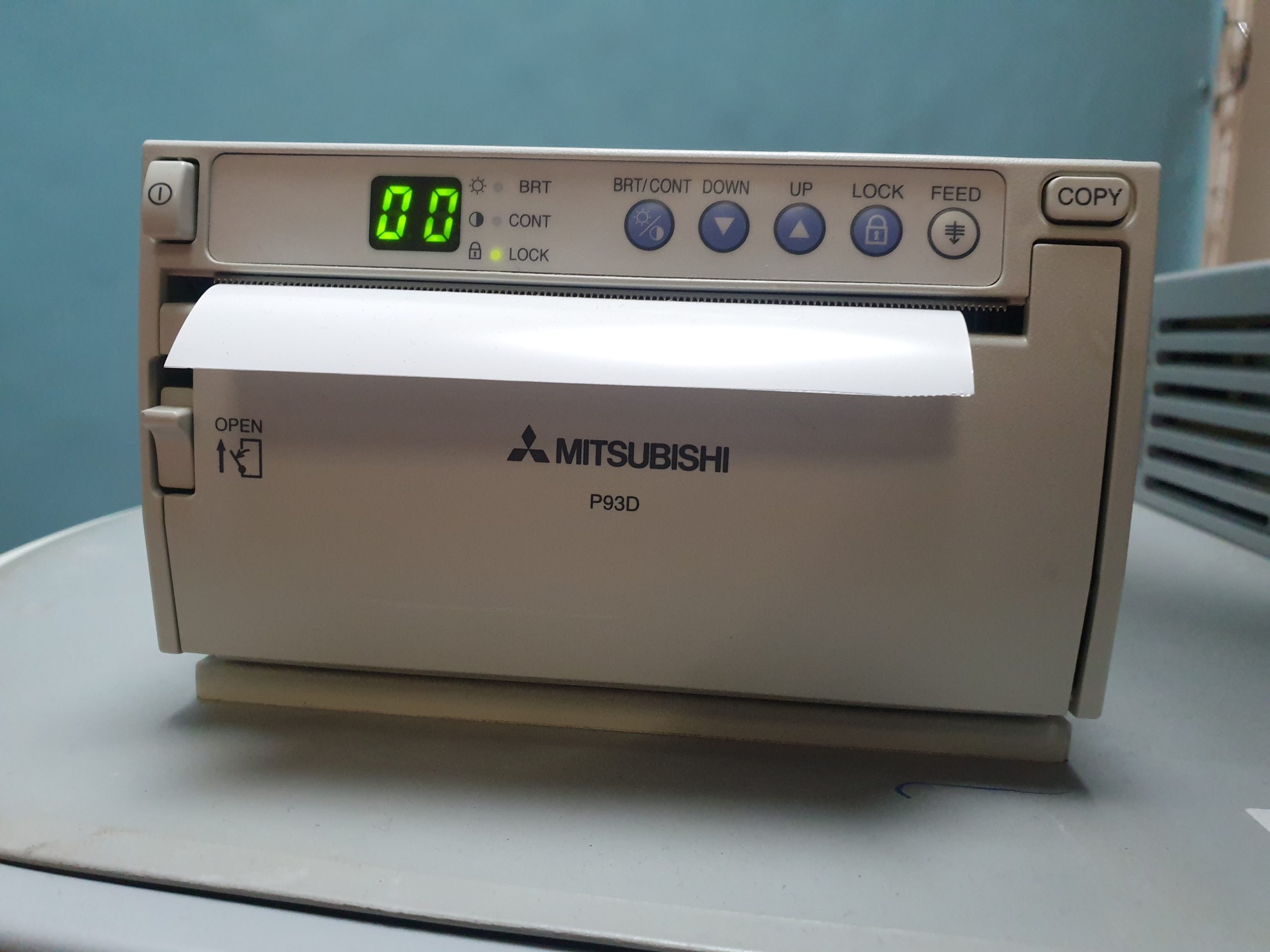 Siemens ACUSON Antares Ultraschallgerät // Kardio // Kardiomaschine mit 3 Sonden und Printer thumbnail 4